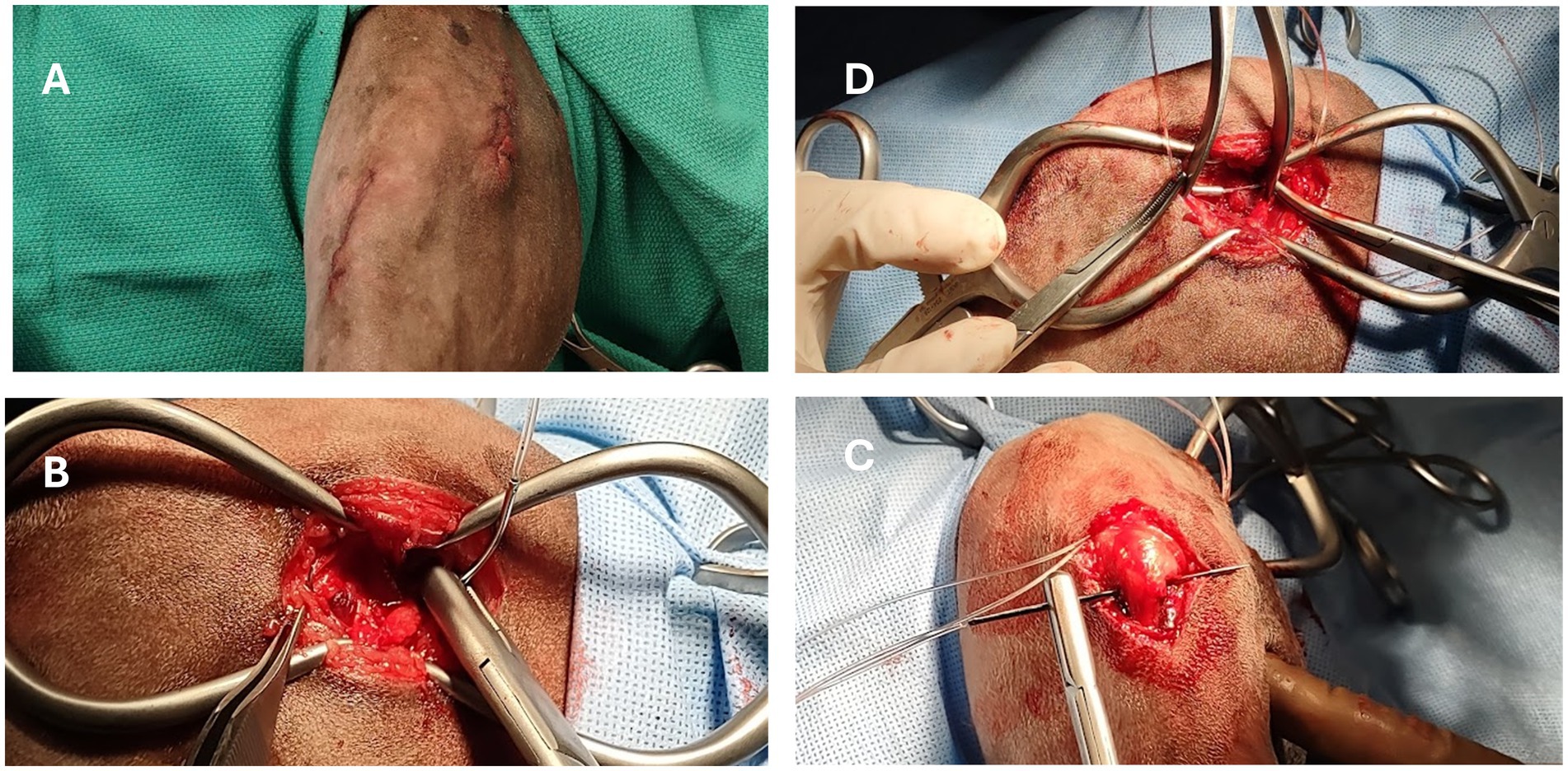 Surgical procedure images show an limb undergoing surgery. In panel A, the limb is prepared with an incision. Panel B shows the opened incision with retractors exposing tissue. Panel C focuses on the exposed area with surgical tools in use. Panel D depicts suturing with instruments handling the tissue. All images include medical instruments and a surgical drape.