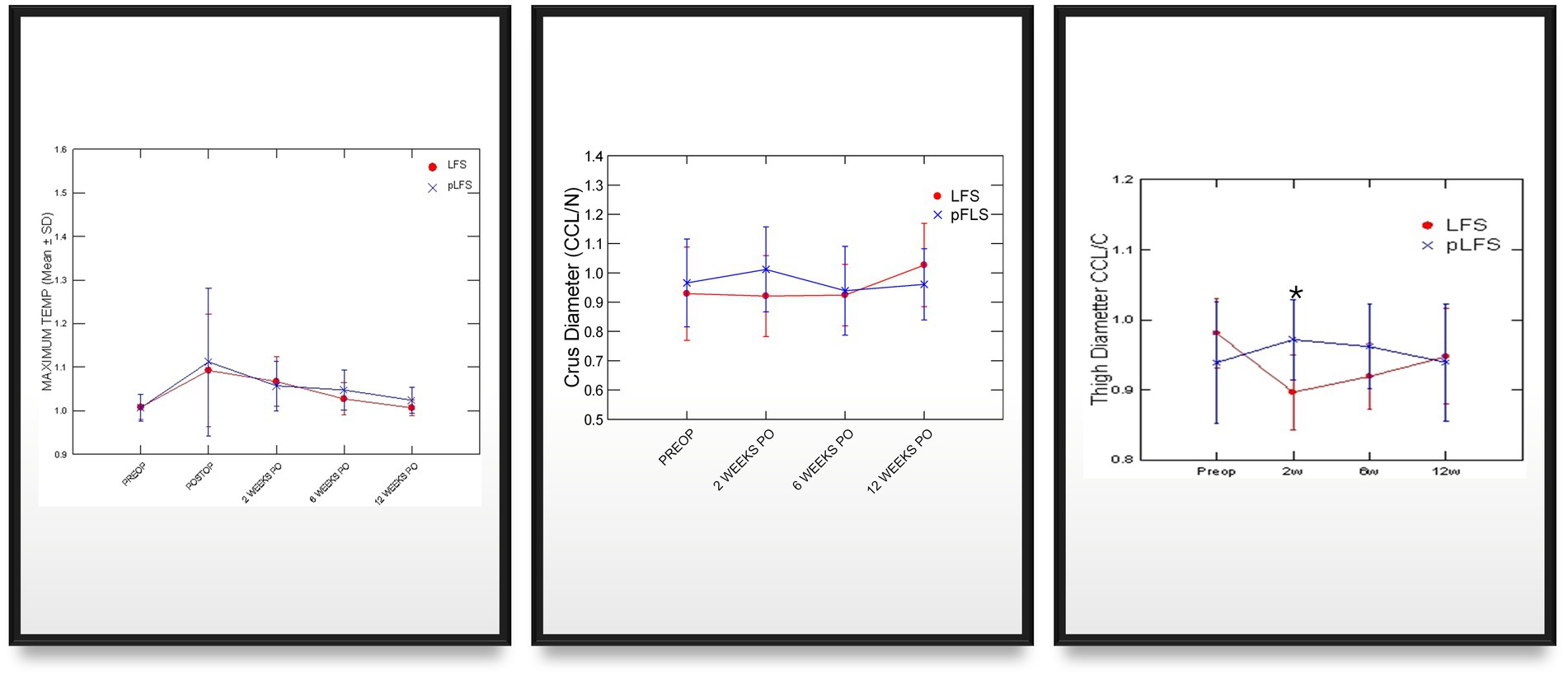 Three line graphs showing comparison data between LFS (red circles) and pLFS (blue crosses). The first graph shows maximum temperature over time from pre-operation to twelve weeks post-operation. The second graph displays crus diameter from pre-operation to twelve weeks post-operation. The third graph presents thigh diameter over the same period. Error bars indicate variability. Each graph highlights different measurements with overlapping data points, showing trends across time points.