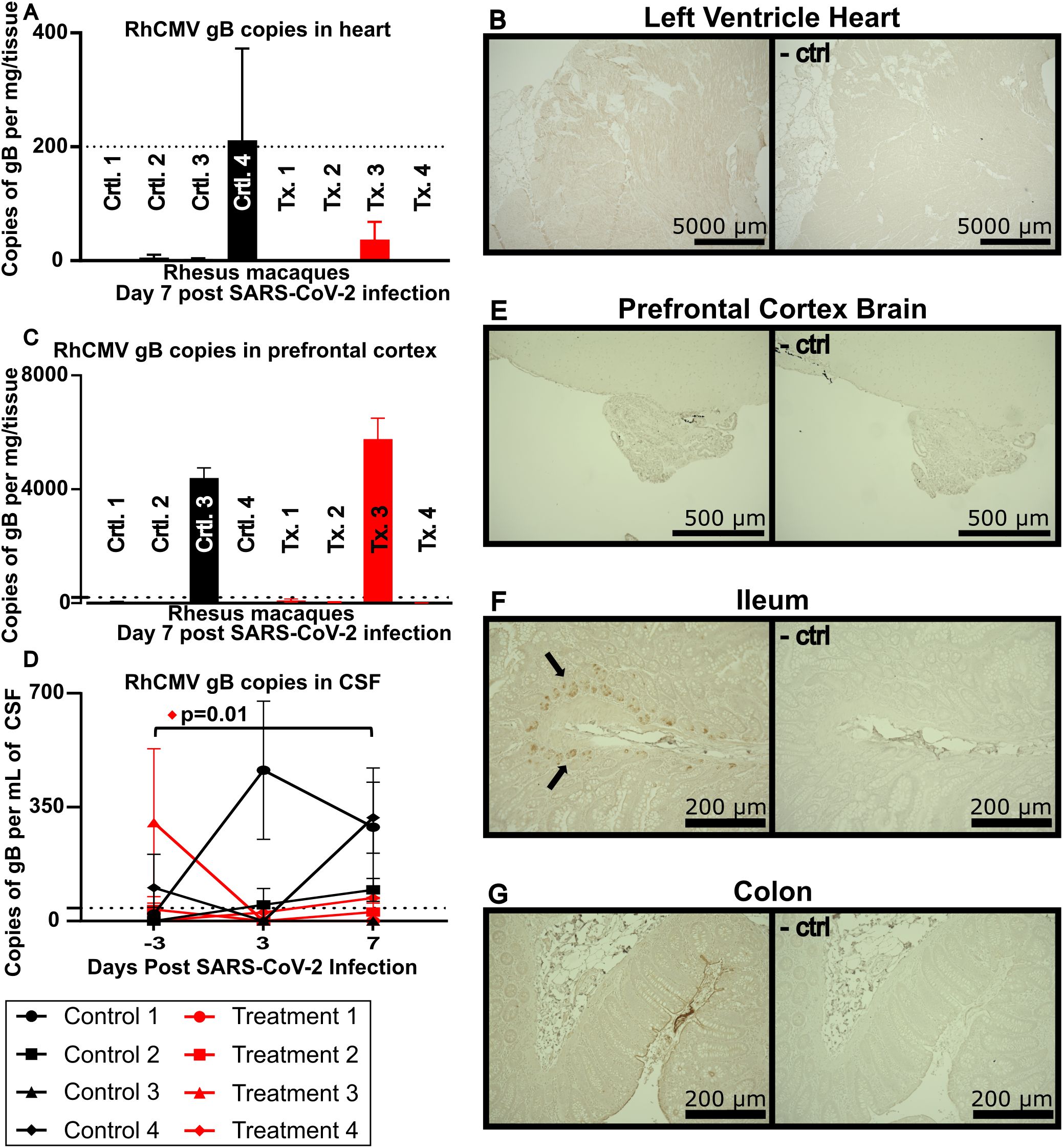 Graphs and images show RhCMV gB copies in various tissues 7 days post-SARS-CoV-2 infection in Rhesus macaques. Charts depict data for heart, prefrontal cortex, and cerebrospinal fluid. Immunohistochemistry images illustrate tissue sections of the left ventricle heart, prefrontal cortex brain, ileum, and colon, comparing treated and control groups. Arrows in the ileum highlight stained areas.