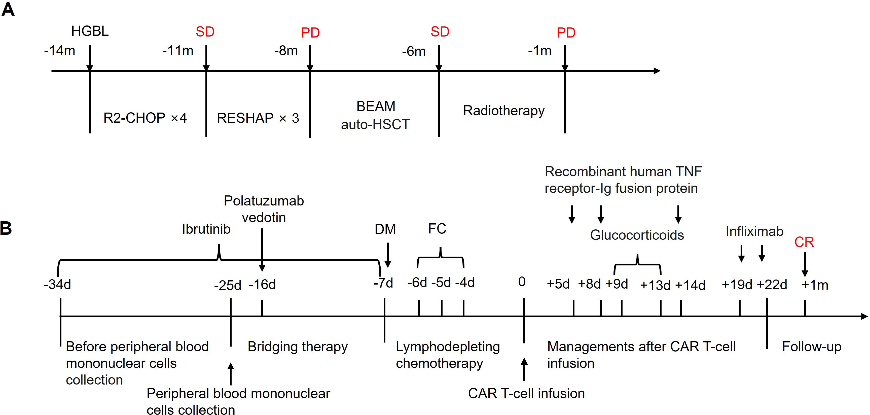 Timeline diagram showing cancer treatment and response. Part A details treatment over 14 months with intervals of chemotherapy (R2-CHOP, RESHAP, BEAM auto-HSCT) and radiotherapy. Status updates: SD (stable disease), PD (progressive disease). Part B details treatment over 34 days including ibrutinib, polatuzumab vedotin, lymphodepleting chemotherapy, CAR T-cell infusion, and follow-up. Additional treatments: glucocorticoids, infliximab. Achievement of complete response (CR) noted at one month.
