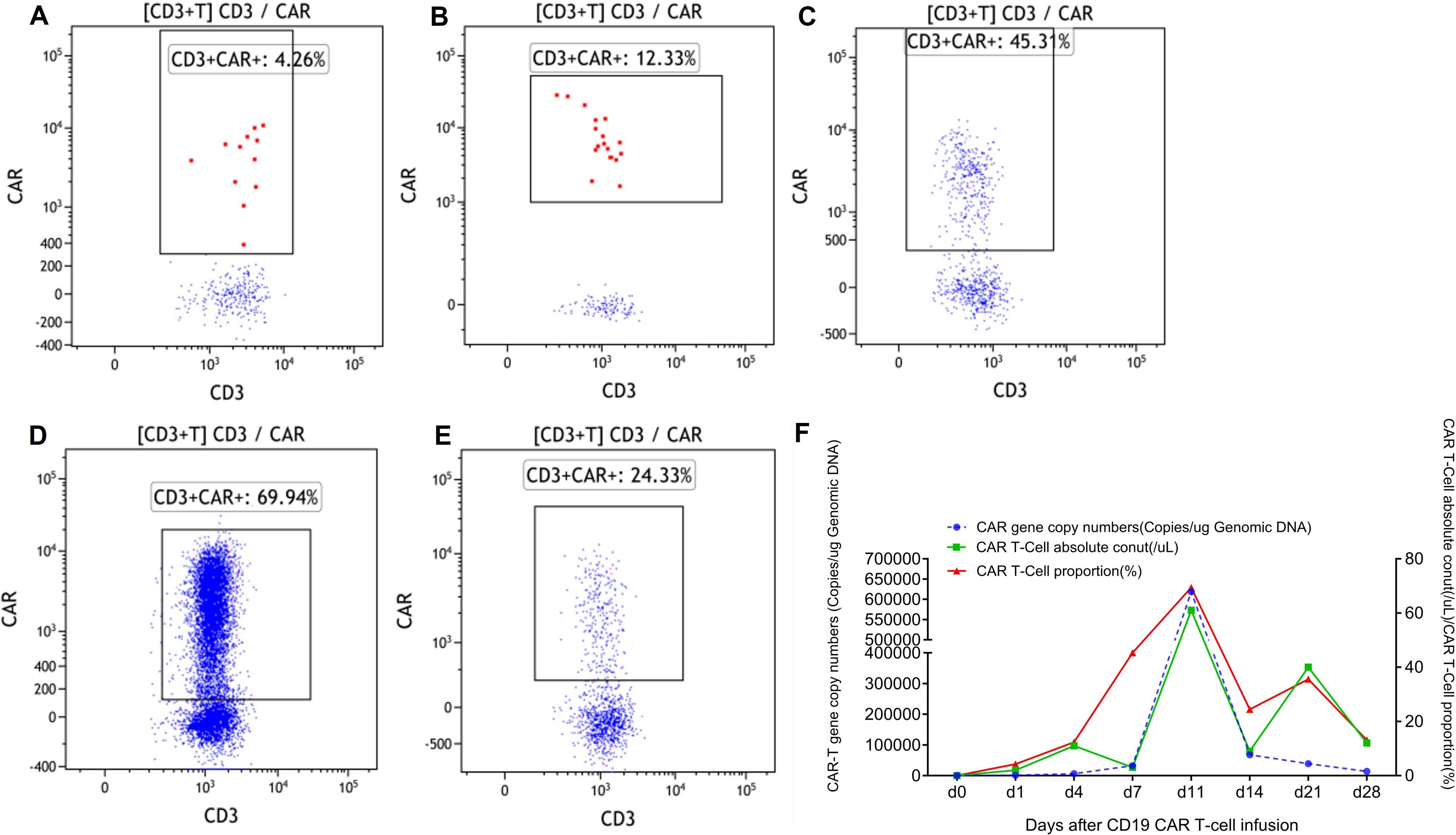 Five scatter plots labeled A to E display CD3 and CAR markers with varying CD3+CAR+ percentages: 4.26% in A, 12.33% in B, 45.31% in C, 69.94% in D, and 24.33% in E. Plot F shows a line graph depicting CAR gene copy numbers, CAR T-cell absolute count, and CAR T-cell proportion over 28 days after CD19 CAR T-cell infusion, with distinct lines for each metric.
