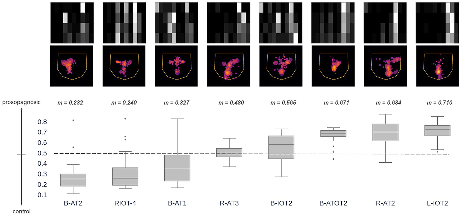 A figure showing a series of brain patterns and bubble plots, each corresponding to different tasks labeled B-AT2, RIOT-4, B-AT1, R-AT3, B-IOT2, B-ATOT2, R-AT2, and L-IOT2. Each task has a mean score ranging from 0.232 to 0.710. Below, a box plot compares control and prosopagnosic groups, illustrating score distributions for each task.