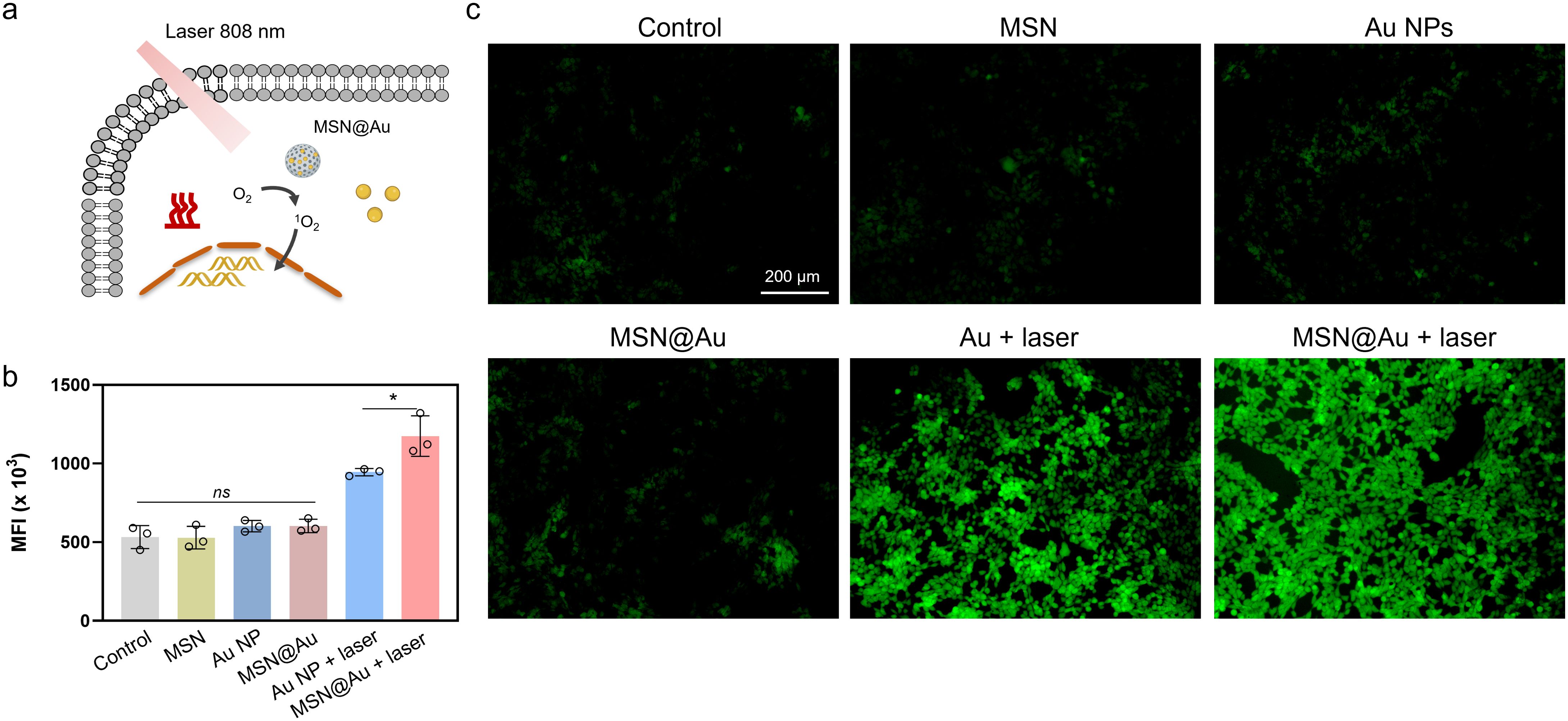 Diagram showcasing the use of an 808 nm laser on MSN@Au particles inducing changes in oxygen states. A bar chart compares mean fluorescence intensity (MFI) across six conditions, highlighting increased MFI for MSN@Au with laser treatment. Fluorescence microscopy images depict green fluorescence under six different conditions: Control, MSN, Au NPs, MSN@Au, Au with laser, and MSN@Au with laser, showing enhanced fluorescence with laser treatments. Scale bar indicates 200 micrometers.