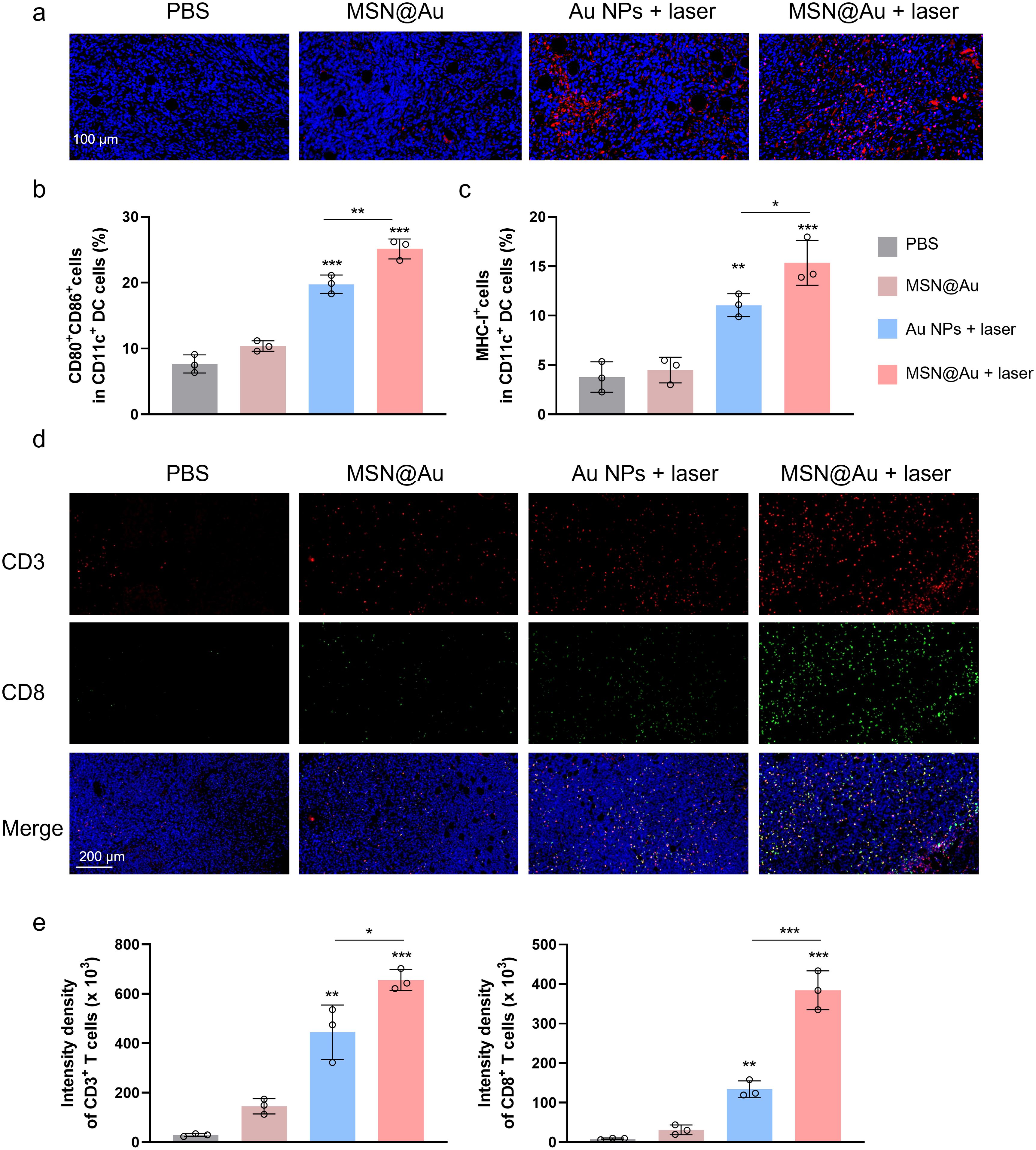 Panel of scientific images and graphs showing the effects of different treatments on immune cells. (a) Microscopic images display cellular staining under various treatments: PBS, MSN@Au, Au NPs plus laser, and MSN@Au plus laser. (b) Bar graph shows the percentage of CD80⁺CD86⁺ cells in CD11c⁺DC cells across treatments, with significant increases in powered treatments. (c) Bar graph shows the percentage of MHC-II⁺ cells in CD11c⁺DC cells, noting an increase in groups treated with lasers. (d) Microscopic images presenting CD3, CD8, and merged views of T cells under different treatments. (e) Bar graphs illustrate the intensity density of CD3⁺ and CD8⁺ T cells, with notable increases following laser treatments.