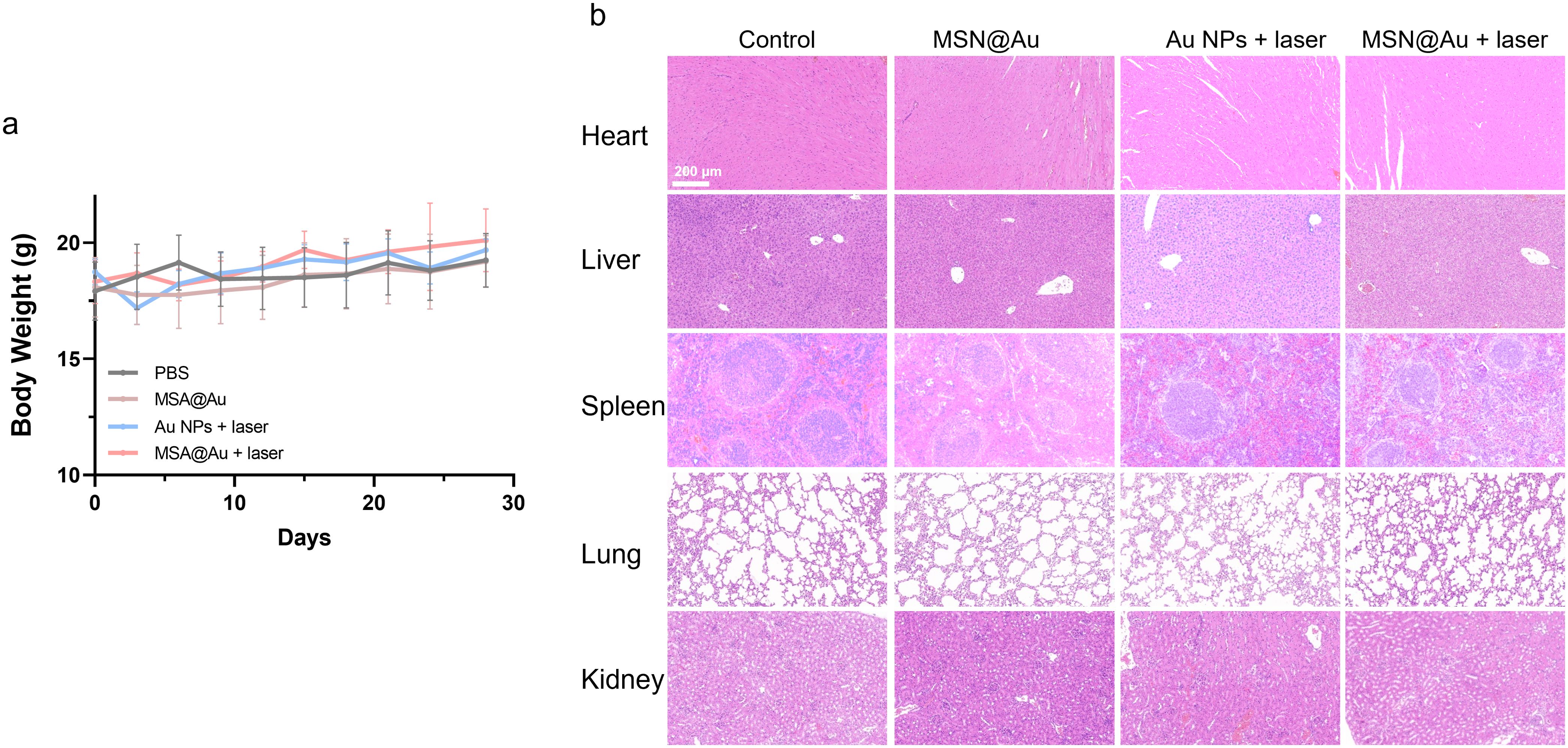 Graph and histology images. Panel (a) shows a line graph illustrating body weight changes over 30 days for different treatments: PBS, MSN@Au, Au NPs with laser, and MSN@Au with laser. Panel (b) includes histology images of heart, liver, spleen, lung, and kidney tissues for control, MSN@Au, Au NPs with laser, and MSN@Au with laser treatments. Each condition is shown in a row, highlighting tissue changes across treatments. Scale bar is 200 micrometers.