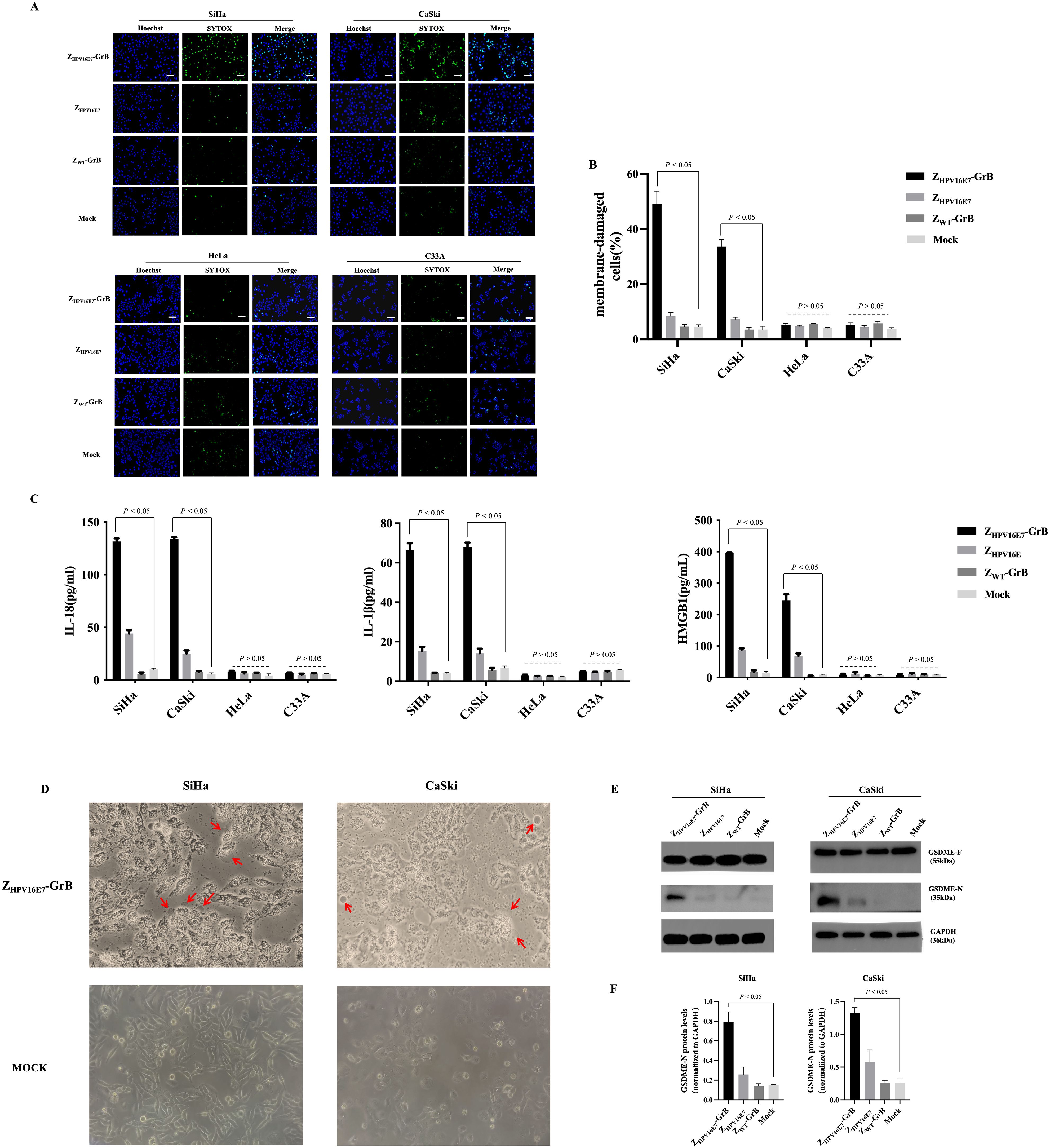 Fluorescent microscopy and bar graphs analyzing membrane damage in different cancer cell lines (SiHa, CaSki, HeLa, C3A) under various treatments. The images show cells stained with Hoechst and SYTOX dyes with merged views. Bar graphs indicate the percentage of membrane-damaged cells and levels of IL-1β and HMGB1 proteins. Additional panels show cell morphology alterations marked by arrows, Western blot analysis identifying protein expression, and bar graphs quantifying protein levels, specifically GSDME cleavage in SiHa and CaSki cells. Statistical significance is noted with P-values.