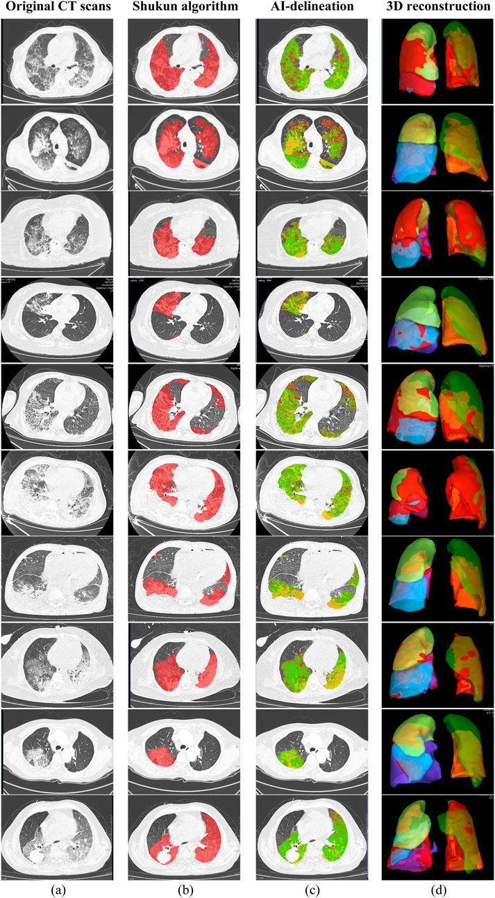 CT scan rows display four columns: original scans, Shukun algorithm highlighting in red, AI delineation in green and yellow, and colorful 3D lung reconstructions. Images showcase varying lung detail interpretations through advanced technologies.