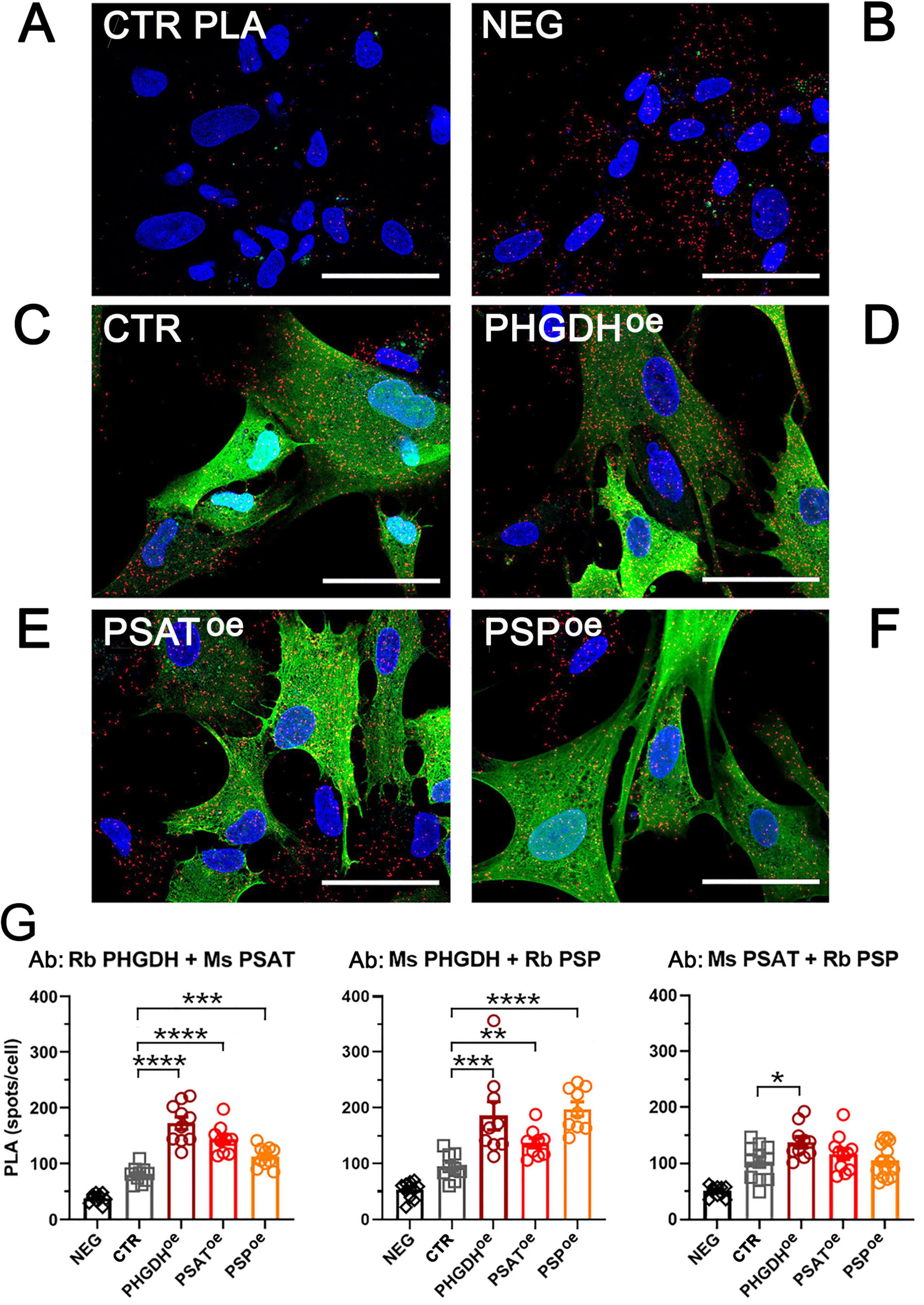 Confocal microscopy images show serinosome formation and GFP-tagged PP proteins expression with blue nuclei and varying green intensities. Panels A-F display different conditions: CTR PLA, NEG, CTR, PHGDHoe, PSAToe, PSPoe. Red spots detected by the PLA assay are indicative of the enzymatic assemblies formation. Panel G presents bar graphs comparing PLA signals under different conditions, with significant differences marked by asterisks. Scale bars are visible.