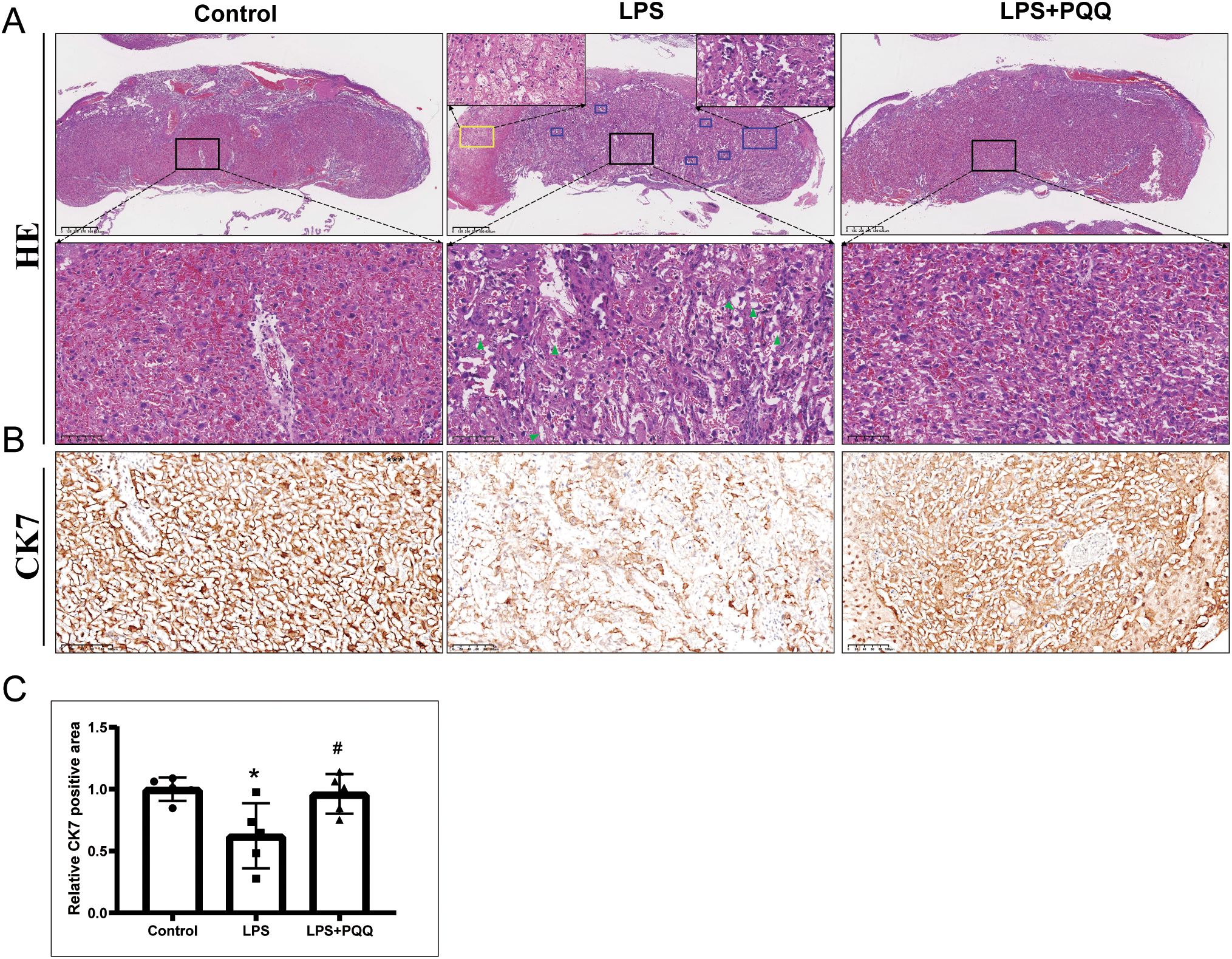 Histological images comparing liver samples under three conditions: Control, LPS, and LPS+PQQ. Panel A shows HE-stained liver tissues, with visible differences in cell morphology and structure between conditions. Panel B displays CK7-stained tissues, showing variation in CK7 expression. Panel C presents a bar chart indicating relative CK7 positive area across conditions, showing a decrease in LPS compared to Control and an increase in LPS+PQQ. Bars are marked to indicate significance.