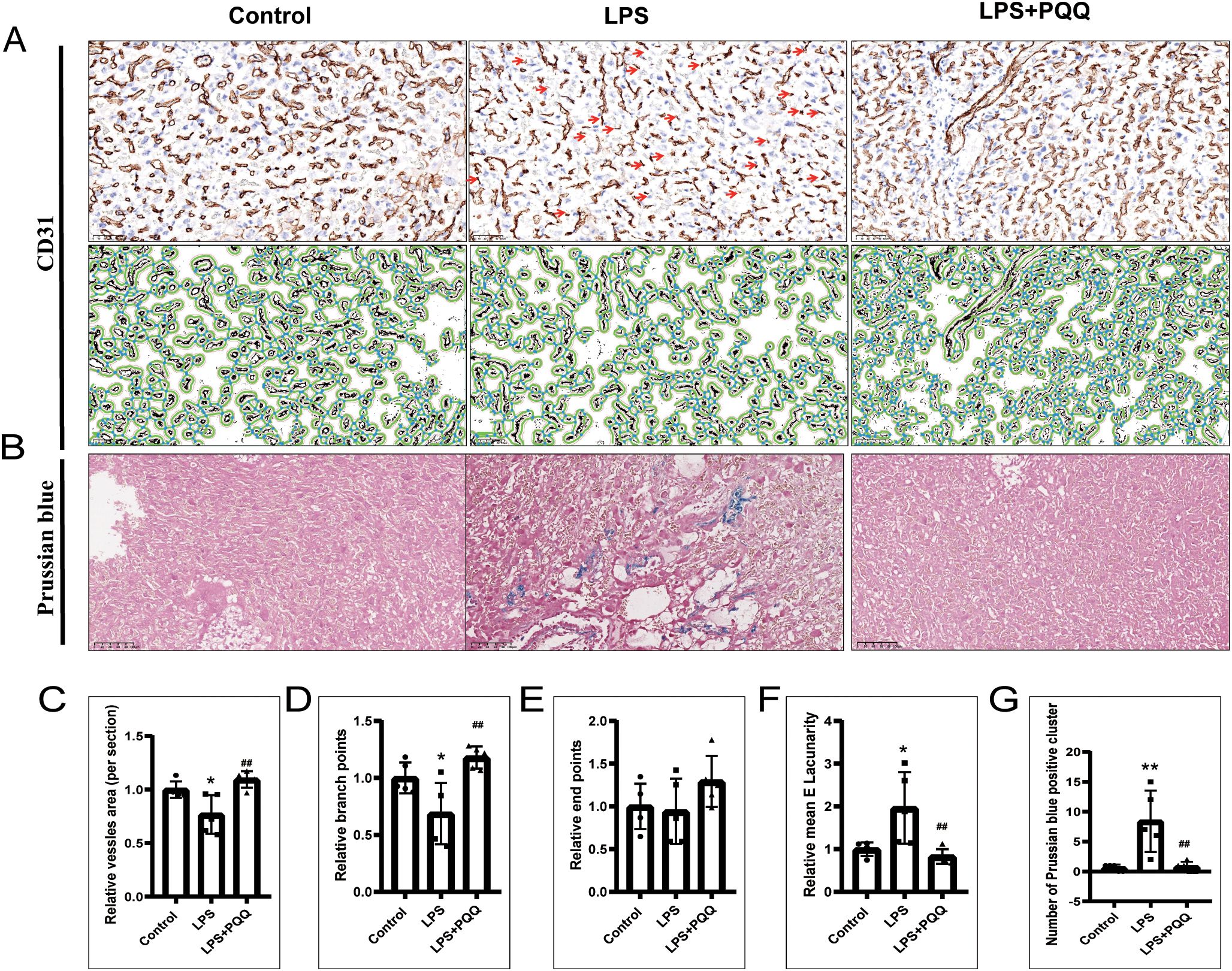 Panel A shows three sets of tissue sections stained with CD31 under Control, LPS, and LPS+PQQ conditions, highlighting blood vessels. Panel B displays tissue sections stained with Prussian blue, showing iron deposits. Graphs C to G depict quantitative analyses: C illustrates relative vessel area; D and E show relative branch and end points; F represents mean Lacunarity; G indicates the number of Prussian blue positive clusters. Data generally show differences between Control, LPS, and LPS+PQQ groups.