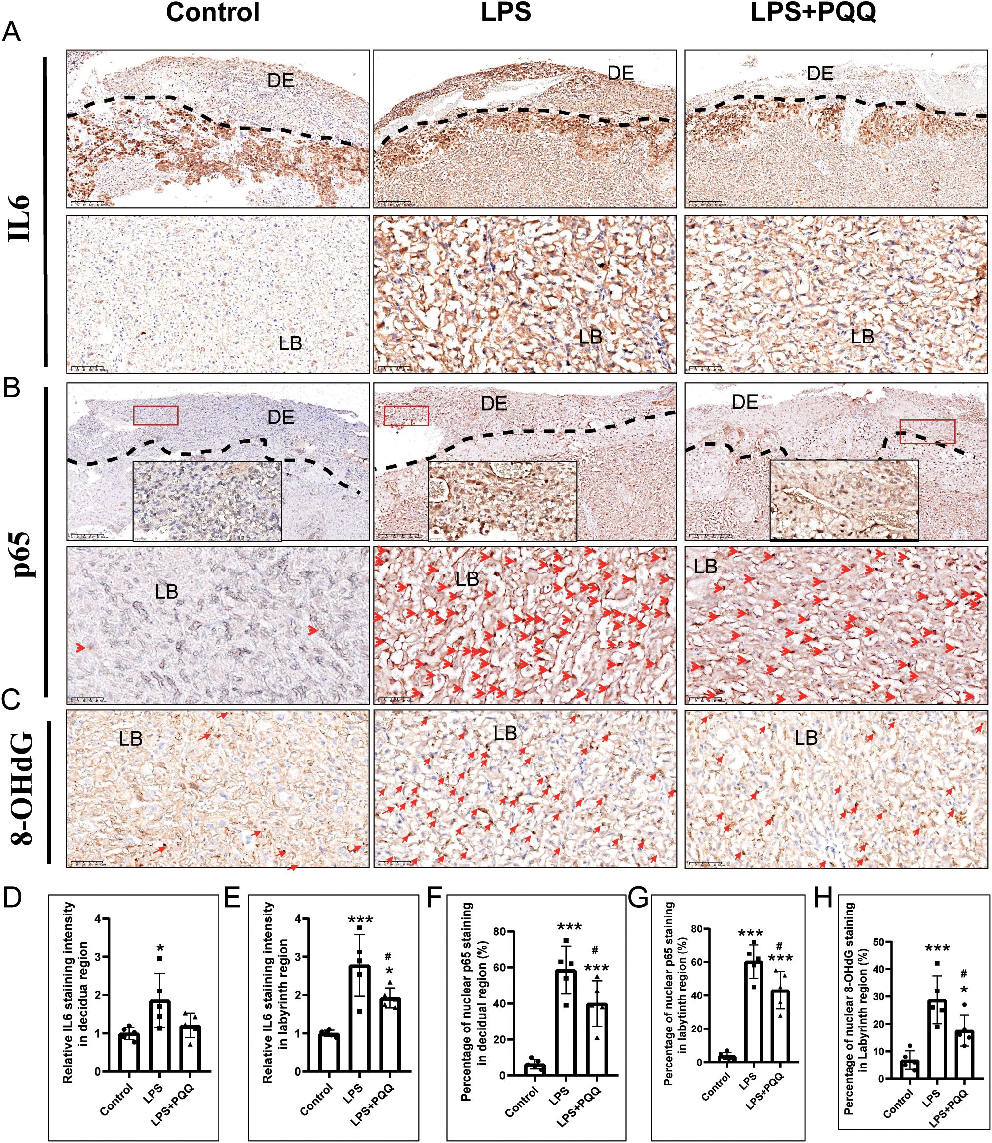 Histological analysis of tissue sections comparing Control, LPS, and LPS+PQQ conditions. Panels A, B, and C display staining for IL6, p65, and 8-OHdG in DE (decidual) and LB (labyrinth) regions. Panels D to H show bar graphs quantifying staining intensity and percentage of positive nuclei under different conditions, indicating increased inflammation and oxidative stress markers in LPS and reduced levels with PQQ.