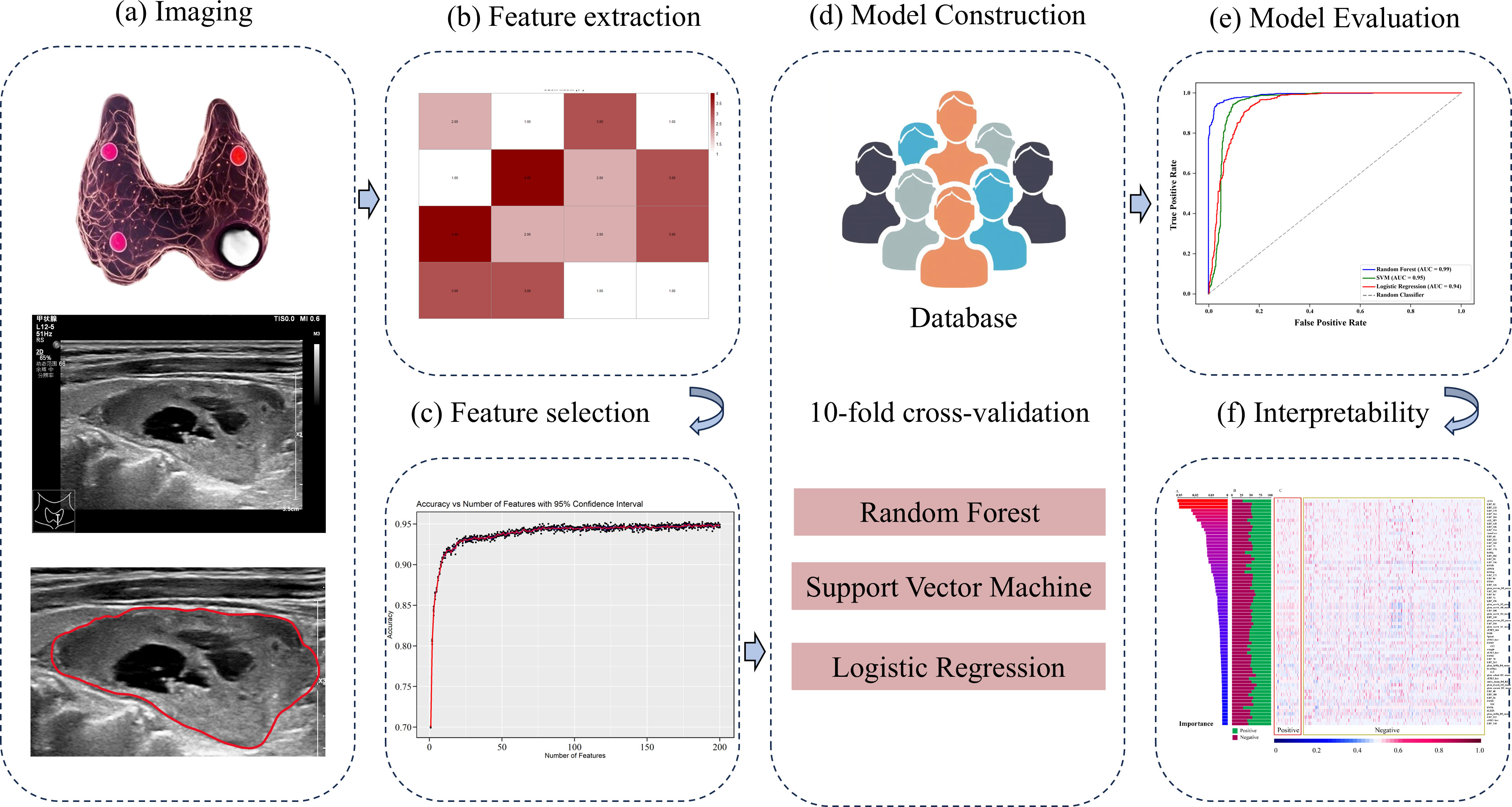 Flowchart illustrating a process: (a) Imaging - includes a 3D thyroid illustration and ultrasound images. (b) Feature extraction - a heatmap. (c) Feature selection - graph showing accuracy vs. number of features. (d) Model construction - database with 10-fold cross-validation, featuring Random Forest, Support Vector Machine, and Logistic Regression. (e) Model evaluation - ROC curves. (f) Interpretability - bar and heatmap showing feature importance.