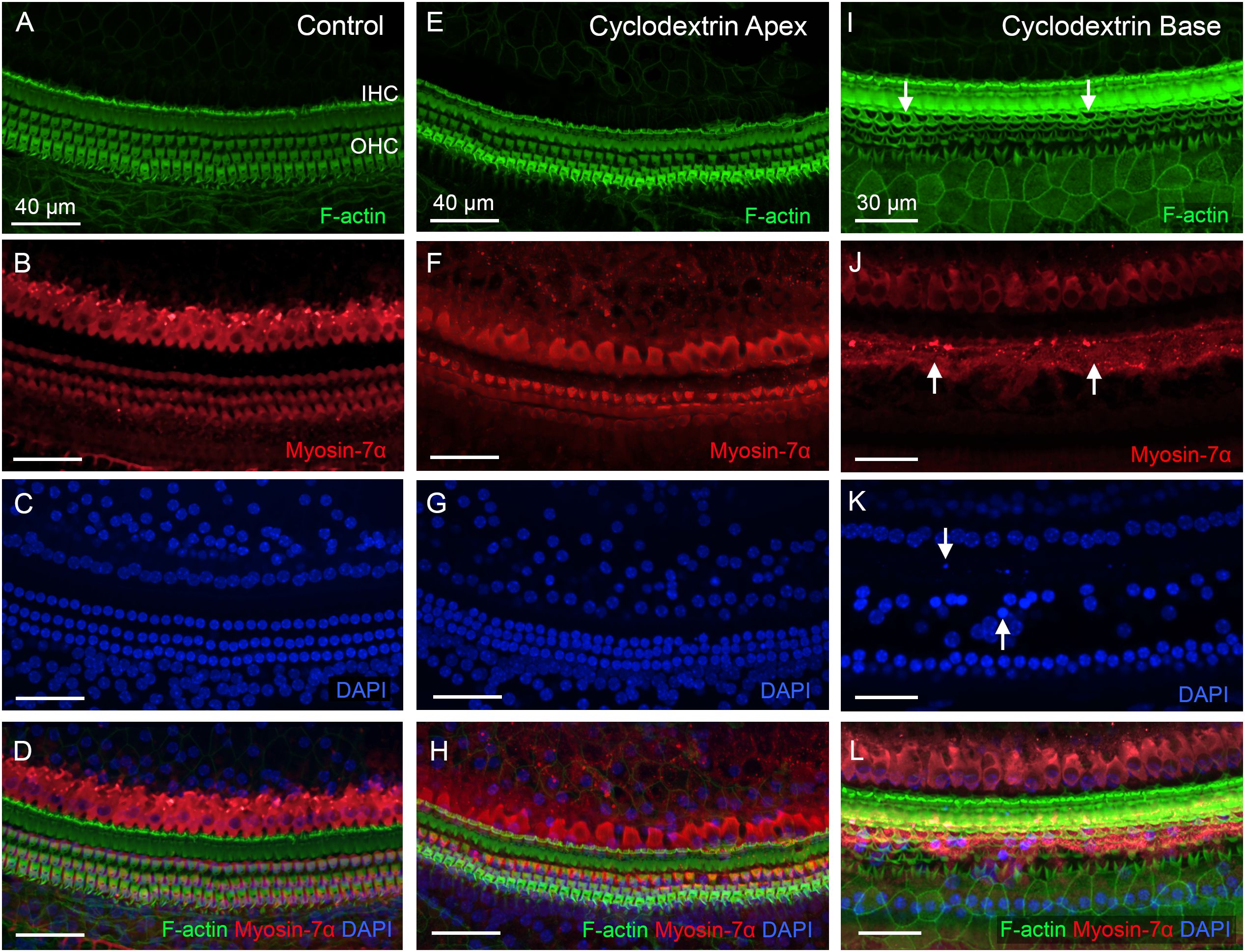 Fluorescent microscopy images show the effect of cyclodextrin on the cochlea. Panels A-D are controls, E-H show the apex treatment, and I-L show base treatment. Panels A, E, and I highlight F-actin in green. B, F, and J highlight Myosin-7a in red, with arrows in I, J, and K indicating specific areas affected by treatment. C, G, and K highlight cell nuclei with DAPI in blue. D, H, and L are overlays of the three stains. Scale bars indicate micrometer measurements.