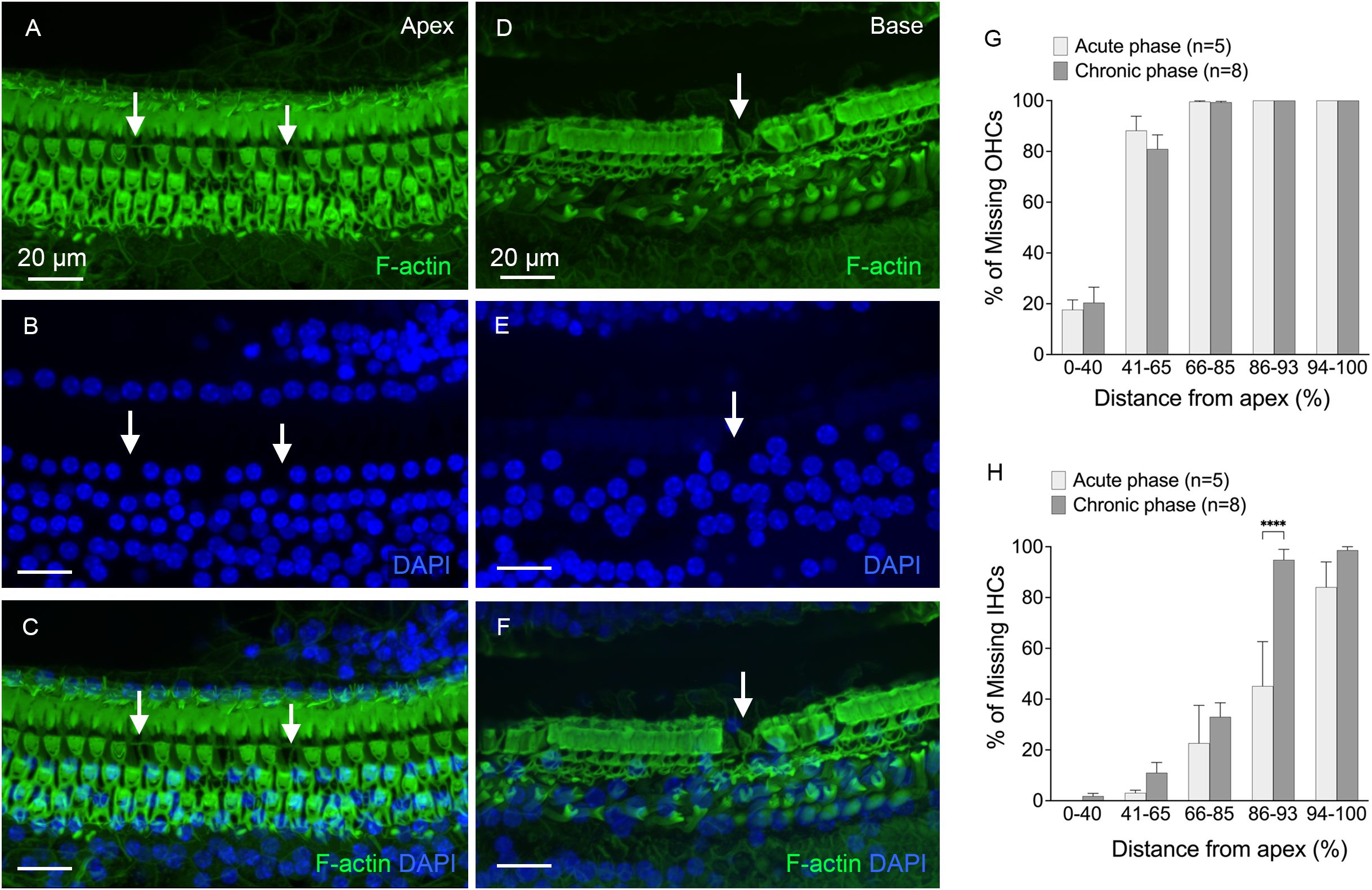 Four panels (A-F) display confocal microscopy images depicting hair cells in the cochlea. A and D show F-actin staining in green, indicating hair cells at the apex and base, respectively, with arrows pointing to areas of interest. B and E depict DAPI-stained nuclei in blue. C and F combine both stains. Two graphs (G and H) illustrate the percentage of missing outer hair cells (OHCs) and inner hair cells (IHCs) across different cochlear regions during acute and chronic phases, showing higher cell loss further from the apex. Arrows and asterisks indicate significant differences.