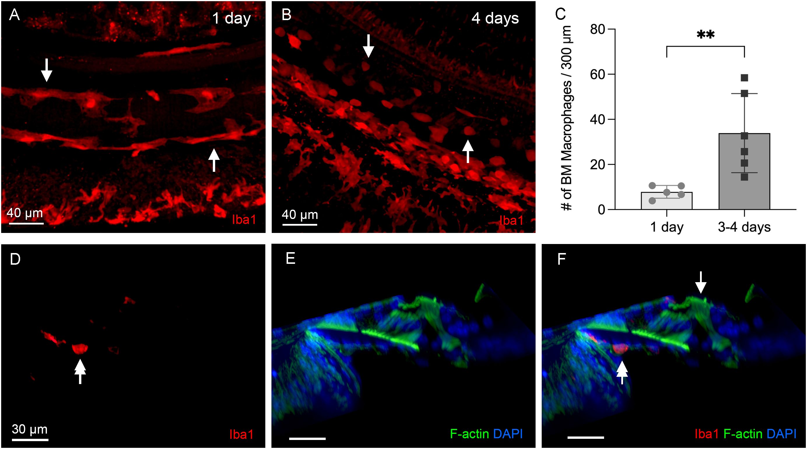 Panels A and B show Iba1-stained macrophages in red at 1 day and 4 days, indicated by arrows. Panel C presents a bar graph comparing the number of macrophages per 300 micrometers between 1 day and 3-4 days, with a significant increase noted at 3-4 days. Panels D to F highlight Iba1 in red, F-actin in green, and DAPI in blue, with arrows pointing to specific features. Scale bars in panels A, B, and D are 40 micrometers and 30 micrometers, respectively.