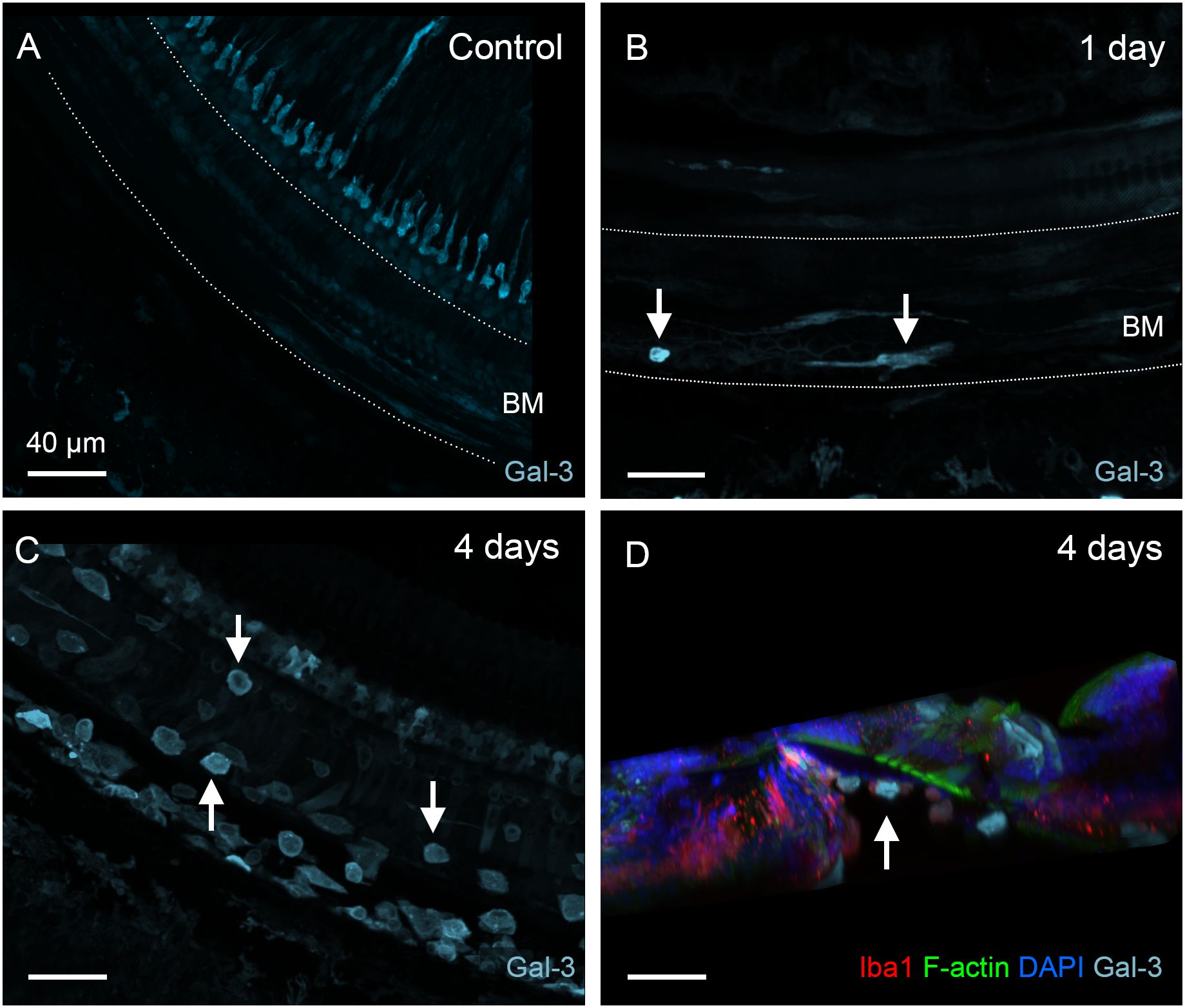 Fluorescent microscopy images showing Gal-3 expression in mouse cochlear tissue over time. Panel A is the control with baseline expression. Panel B shows changes at one day, with increased Gal-3 near the basement membrane (BM). Panel C at four days highlights further expression changes with several marked areas. Panel D at four days uses multicolor labeling to show Iba1, F-actin, DAPI, and Gal-3, indicating cell structure and Gal-3 localization. Scale bar indicates 40 micrometers.