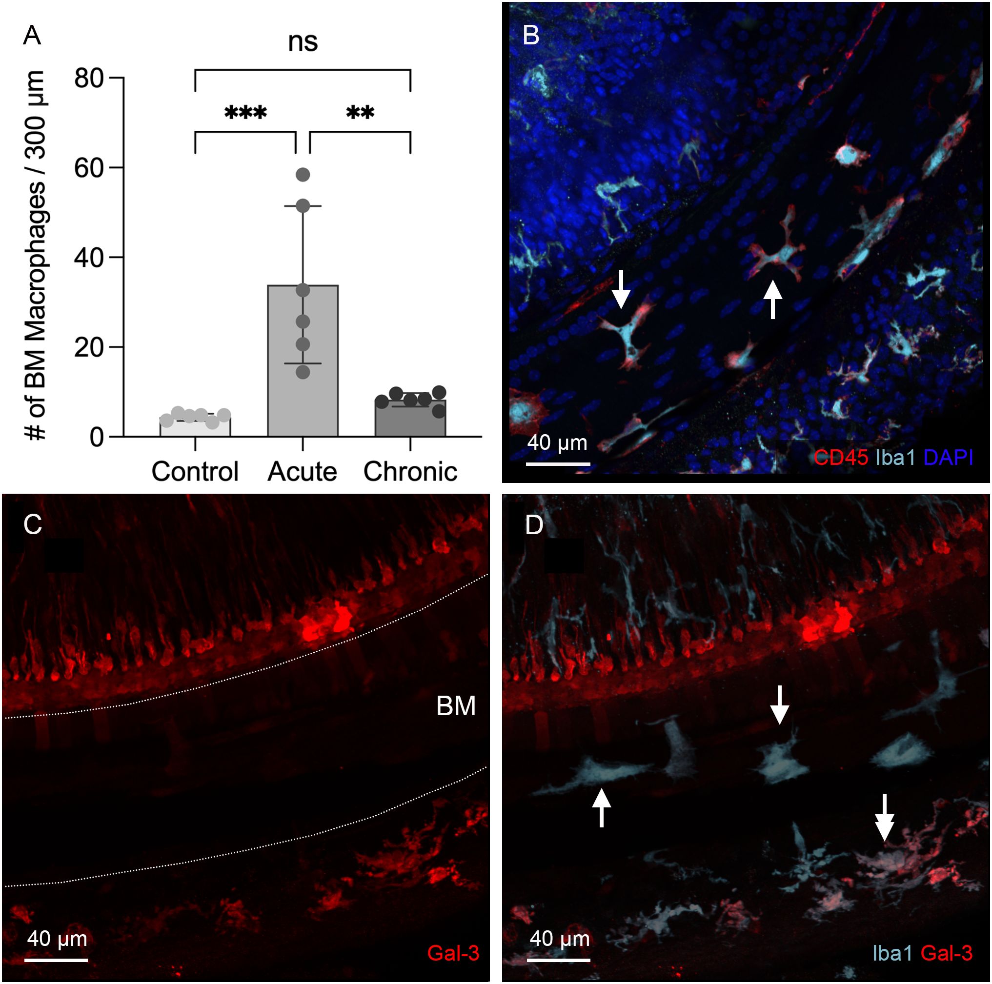 Panel A shows a bar graph comparing bone marrow macrophage numbers across control, acute, and chronic conditions, with significant increases in the acute stage. Panel B is a fluorescent micrograph showing CD45, Iba1, and DAPI staining, with arrows indicating macrophages. Panel C shows Gal-3 staining in a tissue section. Panel D combines Iba1 and Gal-3 stains, with arrows highlighting specific areas. Each panel includes a scale bar of forty micrometers.