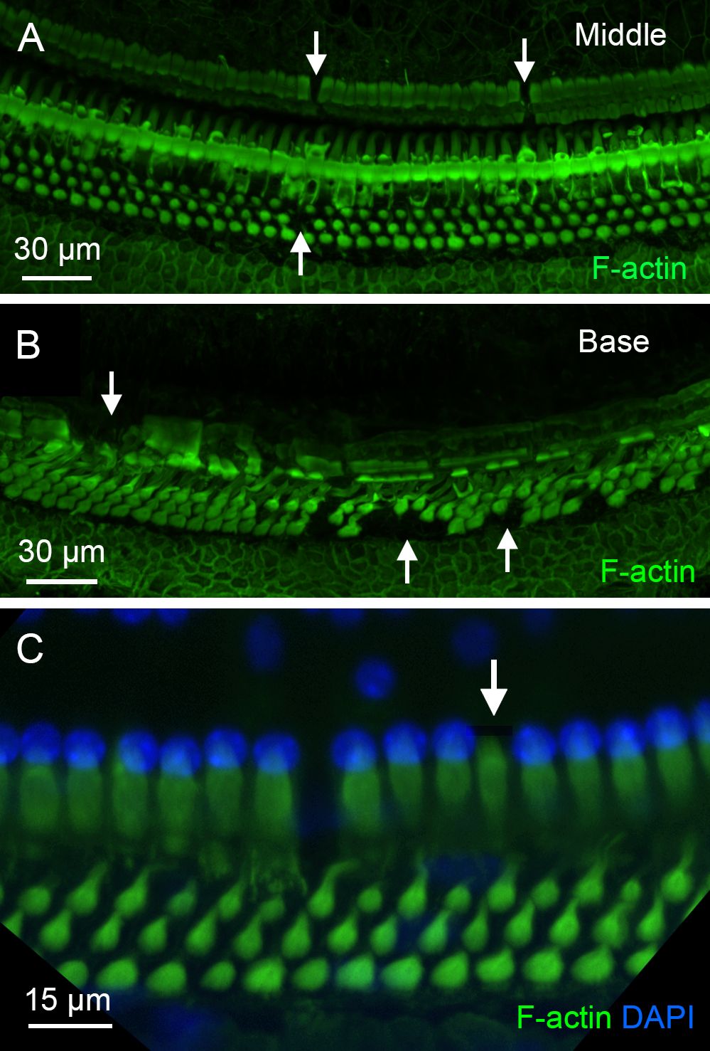 Fluorescent microscopy images showing cellular structures stained for F-actin and DAPI. Panel A displays the middle section with prominent green fluorescence, indicating F-actin presence. Panel B shows the base section with similar green signals. Panel C highlights a detailed view with blue DAPI-stained nuclei and green F-actin structures. Arrows point to specific features, with scale bars indicating 30 micrometers and 15 micrometers for panels A and C.