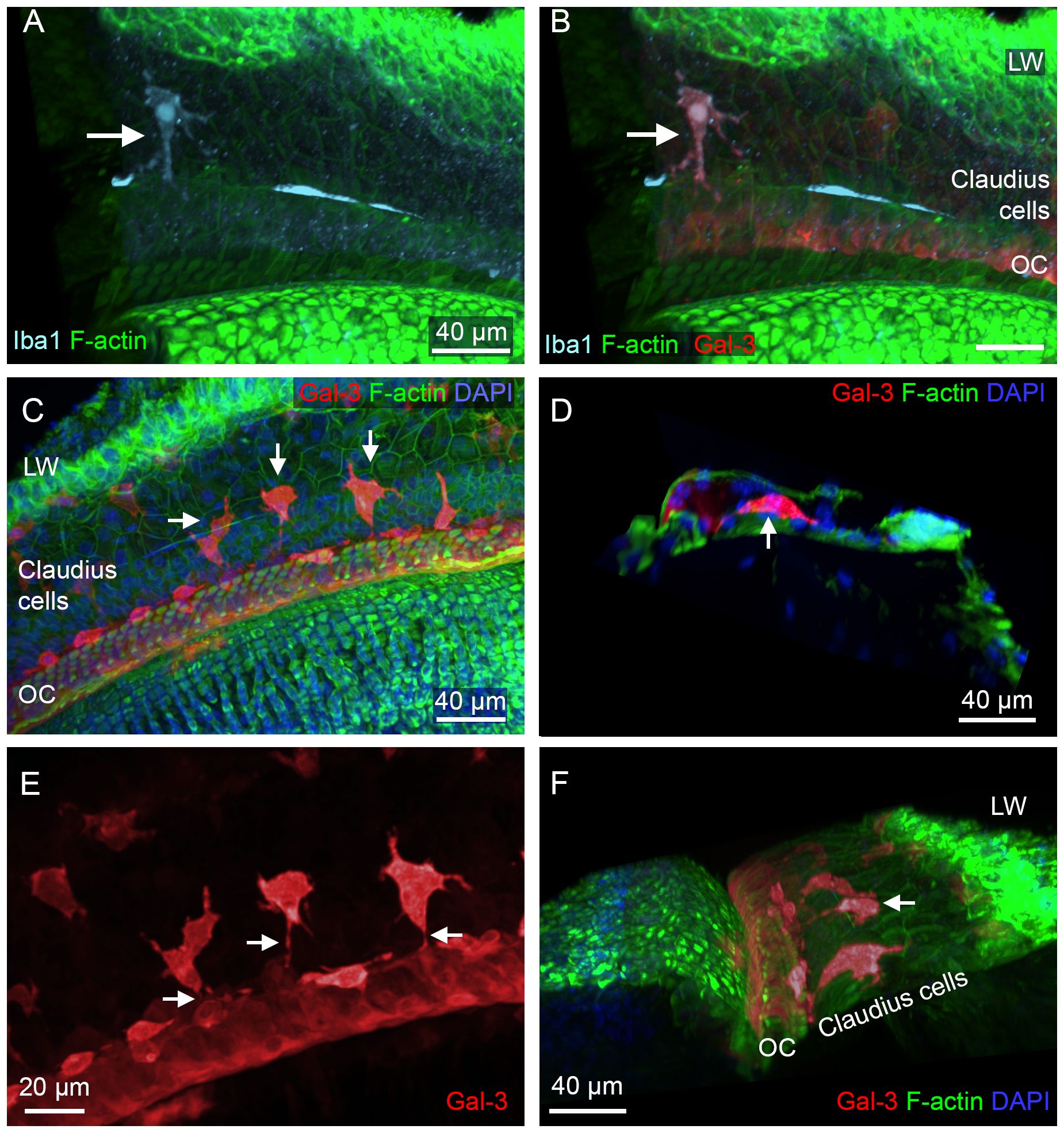 Panels A to F show fluorescent microscopy images of auditory tissue sections. Various markers are used: Iba1 (cyan), F-actin (green), Gal-3 (red), and DAPI (blue). Arrows indicate specific cells or structures, such as Claudius cells and the organ of Corti (OC). The images highlight cellular distribution and labeling along with scale bars marking 40 micrometers or 20 micrometers.