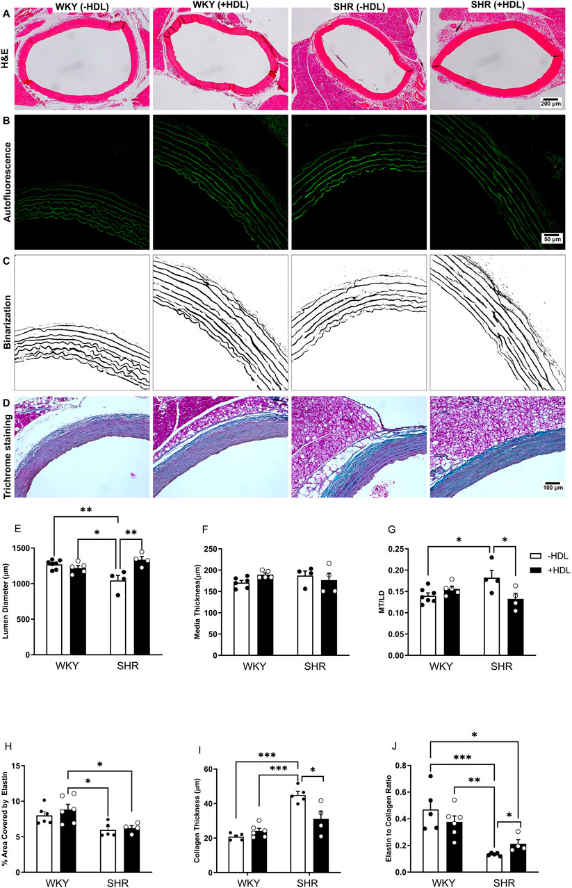 Histological comparisons of artery sections under various conditions. Panel A shows H&E staining of WKY and SHR with and without HDL. Panel B depicts autofluorescence images, while panel C presents binary representations. Panel D illustrates trichrome staining. Graphs E to J display quantitative analyses: lumen diameter, media thickness, media to lumen diameter ratio, elastin area percentage, collagen thickness, and elastin to collagen ratio, respectively. Statistically significant differences are marked with asterisks, indicating varying effects of HDL on WKY and SHR subjects.