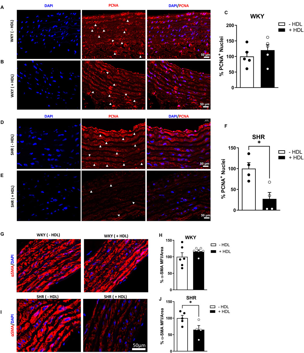 Confocal microscopy images show rat vascular tissue stained with DAPI (blue) and PCNA (red) across different panels. Two groups, WKY and SHR, are shown with and without HDL treatment. Arrows indicate PCNA-positive nuclei. Graphs quantify % PCNA-positive nuclei and % α-SMA MFI/Area in both groups, showing significant differences upon HDL treatment. Scale bar is 50 micrometers.