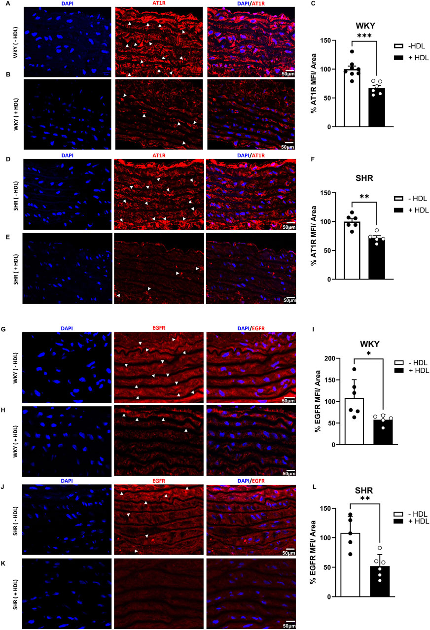 Immunofluorescence microscopy images showing DAPI-stained nuclei in blue and AT1R or EGFR expression in red in WKY and SHR tissues, with and without HDL treatment. Arrowheads indicate highlighted regions. Bar graphs (C, F, I, L) quantify % AT1R or EGFR mean fluorescence intensity (MFI) per area, comparing -HDL and +HDL groups for WKY and SHR. Statistical significance is indicated by asterisks. Scale bar equals fifty micrometers.