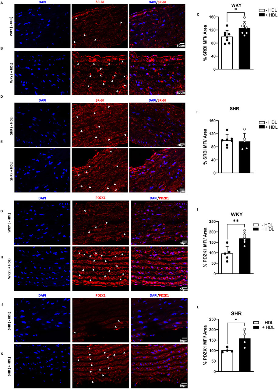 Fluorescent images and bar graphs illustrating the expression levels of SR-BI and PDZK1 in WKY and SHR rat aorta with and without HDL treatment. Panels A, B, D, E, G, H, J, and K show DAPI-stained (blue) and red fluorescent staining for SR-BI and PDZK1; arrowheads indicate positive staining. Panels C, F, I, and L display bar graphs of percentage SR-BI and PDZK1 MFI per area, showing increased expression with HDL in WKY and SHR rats. Images include scale bars of 50 micrometers.
