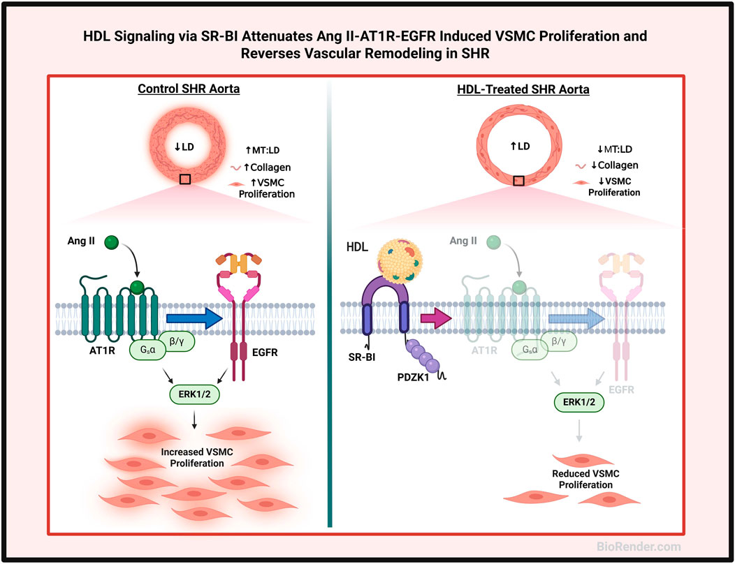 HDL signaling via SR-BI attenuates Ang II-AT1R-EGFR induced VSMCs proliferation and reverses vascular remodeling in SHR. The left panel shows control SHR aorta with increased low-density to high-density lipoprotein ratio, collagen, and VSMCs proliferation. Ang II stimulates AT1R leading to ERK1/2 activation and increased proliferation. The right panel depicts HDL-treated SHR aorta with a decreased low-density to high-density lipoprotein ratio, collagen, and VSMCs proliferation. HDL interacts with SR-BI, reducing the Ang II effect, leading to reduced EGFR activation and proliferation.