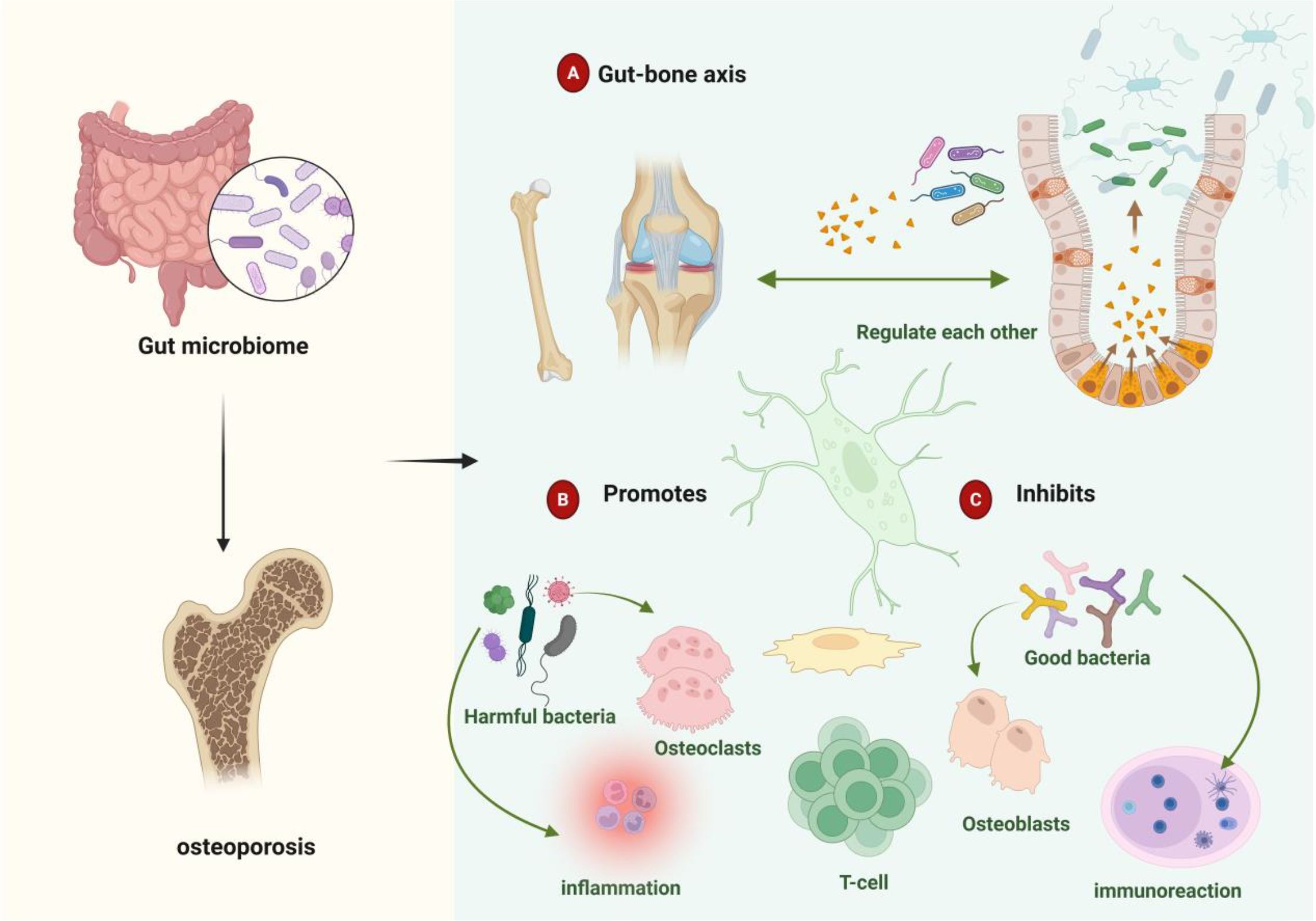 Diagram illustrating the relationship between the gut microbiome and osteoporosis. It shows the gut-bone axis, where gut bacteria and bone regulate each other. Harmful bacteria are shown to promote inflammation and osteoclast activity, while good bacteria inhibit these processes by enhancing osteoblast activity and immune reactions.