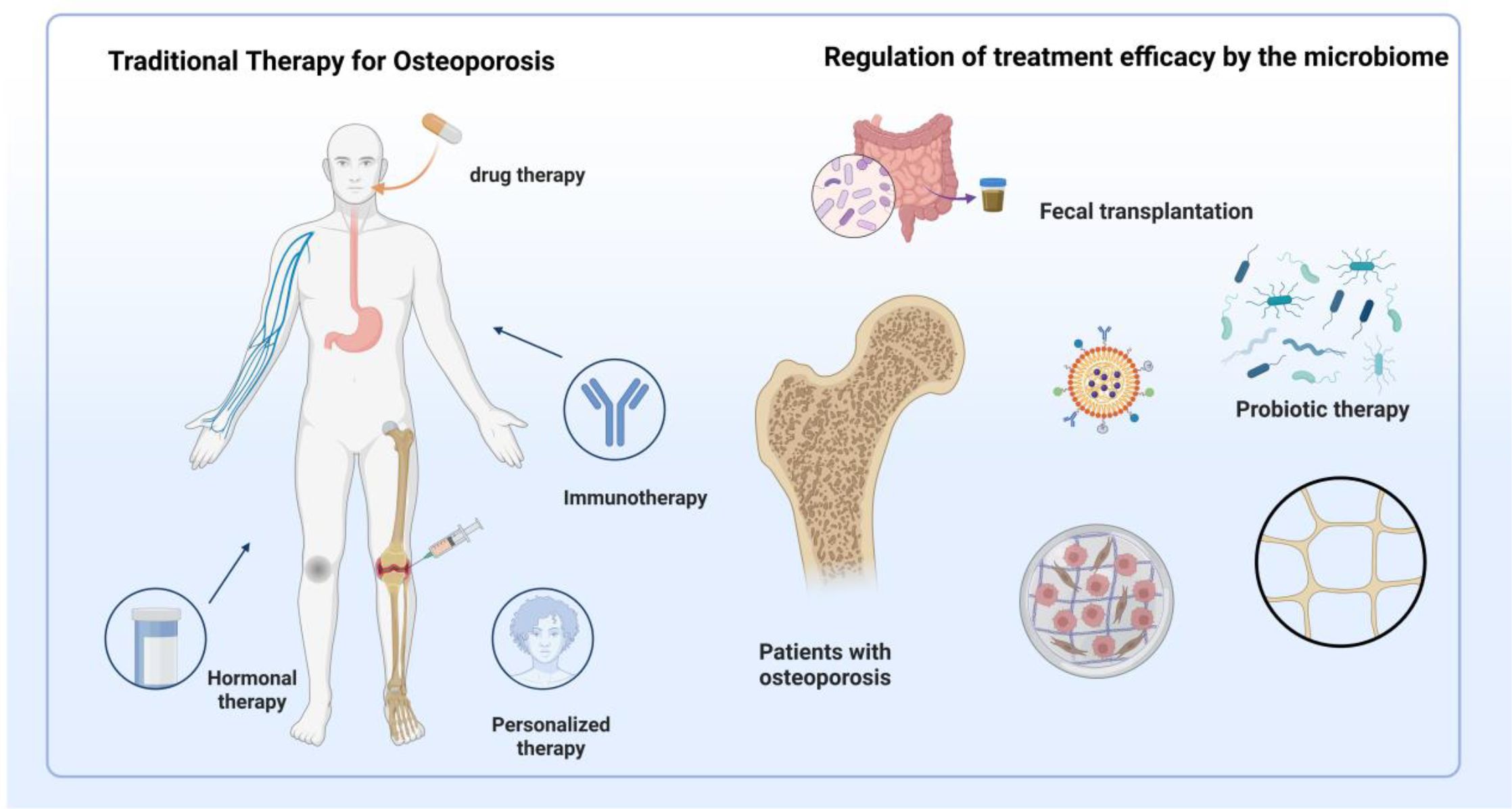 Illustration contrasting traditional osteoporosis therapies with microbiome-regulated treatment efficacy. Left: Traditional therapies like drug, immunotherapy, hormonal, and personalized therapies. Right: Microbiome-based approaches include fecal transplantation and probiotic therapy, linked to bone health in patients with osteoporosis.