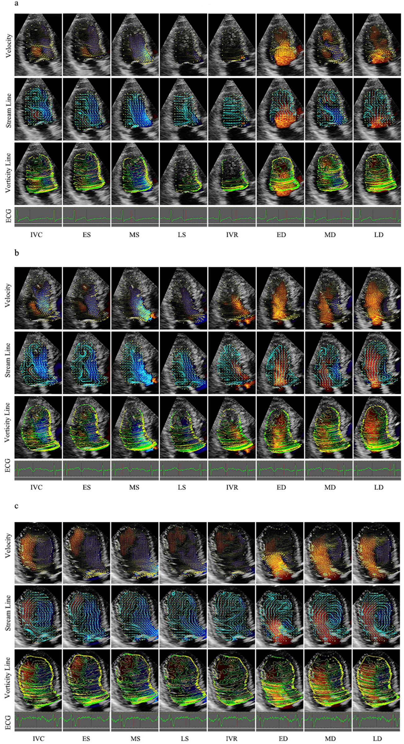 Triptych of medical ultrasound images, labeled as a, b, and c, each showing cardiac dynamics across eight phases. Rows display Velocity, Stream Line, and Vorticity Line visualizations, with corresponding ECG readings at the bottom. Patterns in color depict different phases: Isovolumetric Contraction (IVC), End-Systole (ES), Mid-Systole (MS), Late Systole (LS), Isovolumetric Relaxation (IVR), Early Diastole (ED), Mid-Diastole (MD), and Late Diastole (LD).