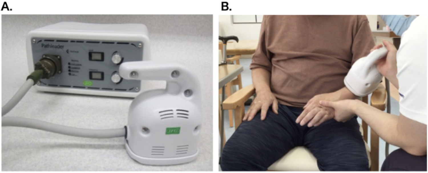 A. A close-up view of a medical device labeled \"Pateleader,\" connected by a cable, with dials and indicators on the front panel. B. A person is sitting while another individual uses the medical device on their forearm.