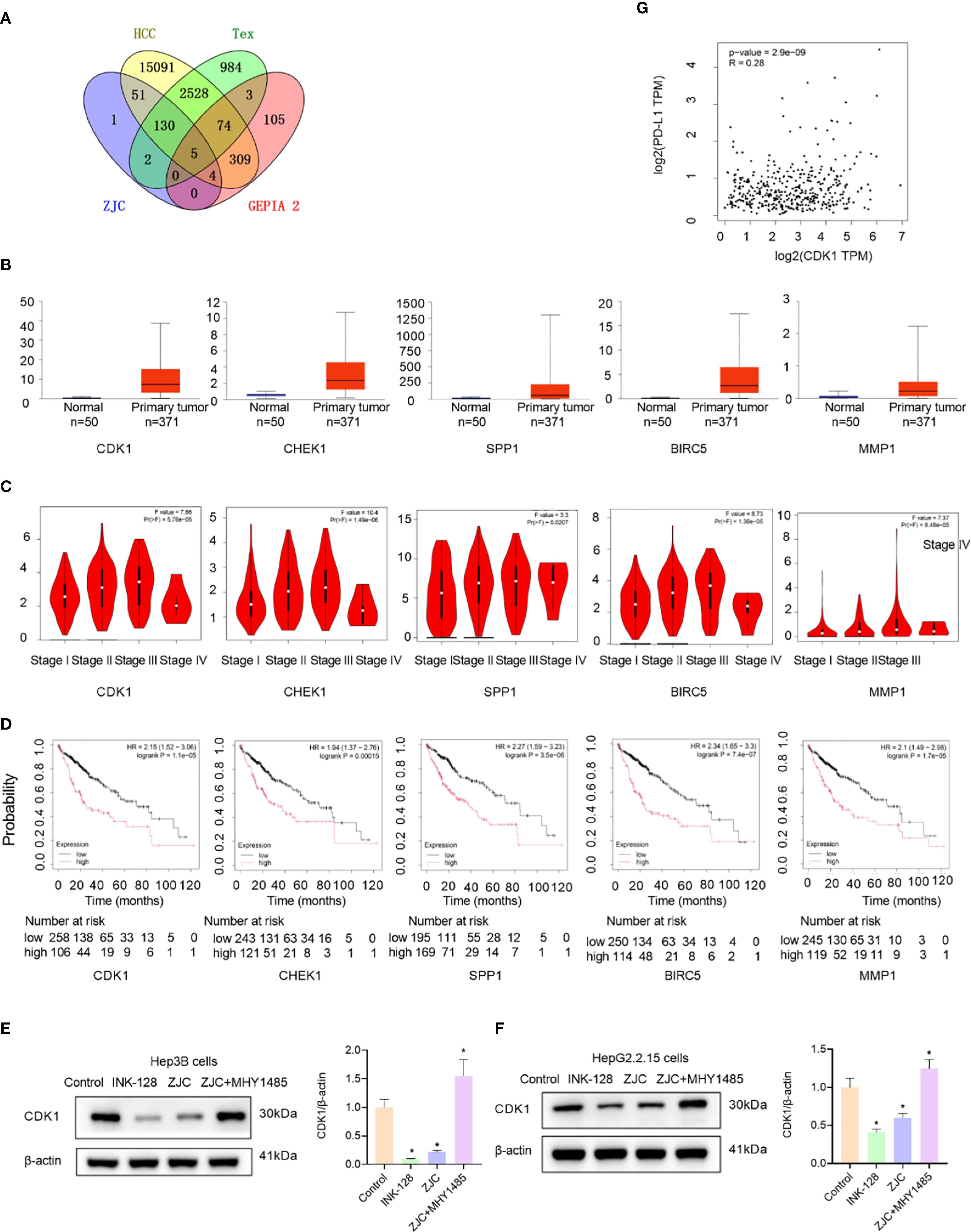 A Venn diagram and multiple data visualizations in panels labeled A to G. Panel A shows overlapping gene sets in a Venn diagram. Panel B contains box plots comparing gene expression levels in normal and primary tumor samples for CDK1, CHEK1, SPP1, BIRC5, and MMP1. Panel C displays violin plots showing expression across cancer stages. Panel D presents Kaplan-Meier survival curves for each gene. Panel E and F show Western blot analyses and bar graphs for CDK1 expression in Hep3B and HepG2.2.15 cell lines. Panel G presents a scatter plot correlating CDK1 and PDL1 expression levels with statistical values.