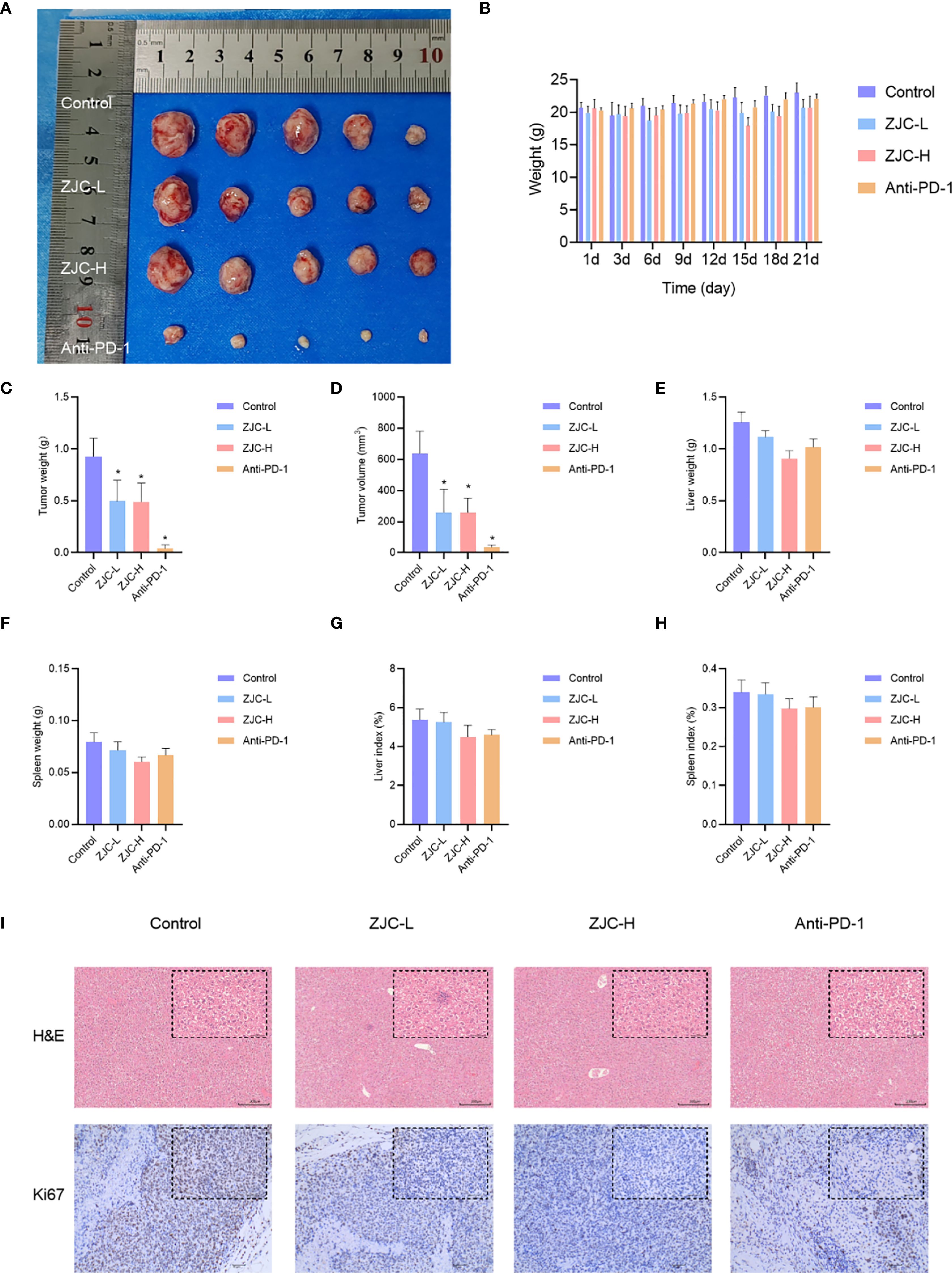 Panels depict tumor and tissue analysis from different treatment groups. Panel A shows excised tumors compared to a ruler for size reference. Panel B displays a line graph of weight over time for control, ZJC-L, ZJC-H, and Anti-PD-1 groups. Panels C to H present various bar graphs comparing tumor weight, volume, liver weight, spleen weight, liver index, and spleen index across treatment groups. Panel I contains histological images stained with H&E and Ki67 for each group, showing tissue morphology and proliferation.