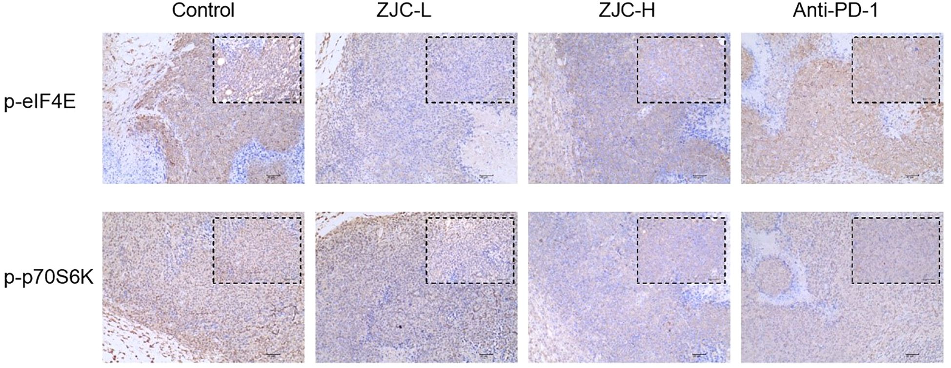 Immunohistochemistry images showing expression of p-eIF4E and p-p70S6K in tissues. Rows represent different protein markers, and columns represent different treatments: Control, ZJC-L, ZJC-H, and Anti-PD-1. Each image contains a dashed rectangle indicating a specific region of interest.