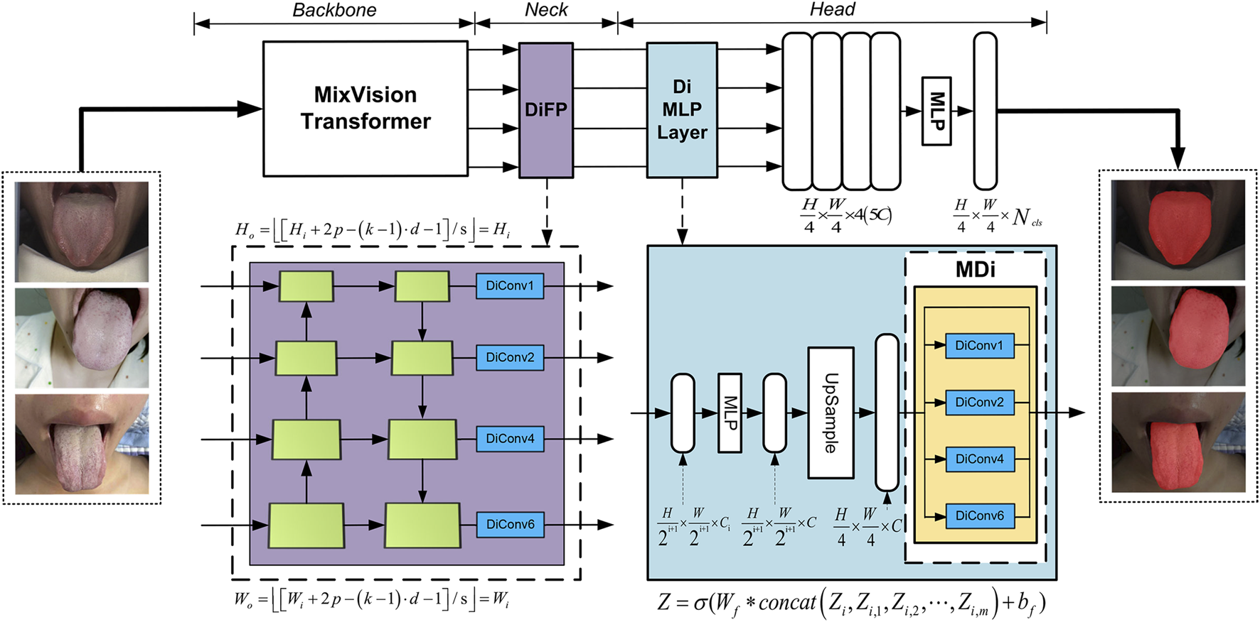Diagram showing a neural network architecture for tongue image processing. The system includes a Backbone with a MixVision Transformer, a Neck with DiFP, and a Head consisting of a Di MLP Layer and MLP layers, leading to tongue image segmentation. Input images of tongues on the left transform to segmented images on the right, highlighting specific areas. Mathematical equations and diagrams detail convolutional layers and operations within the process.
