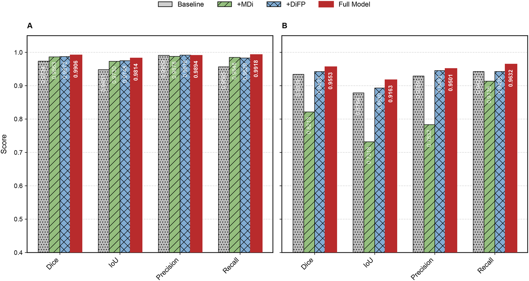 Bar graphs comparing different models' performance across metrics. Graph A shows the Full Model in red outperforming others in Dice, IoU, Precision, and Recall scores, with values above 0.98. Graph B depicts similar metrics with Full Model scores slightly lower, but still leading with scores like 0.9553 in Dice. Models include Baseline, +MDi, +DiFP, and Full Model, with color codes for each.