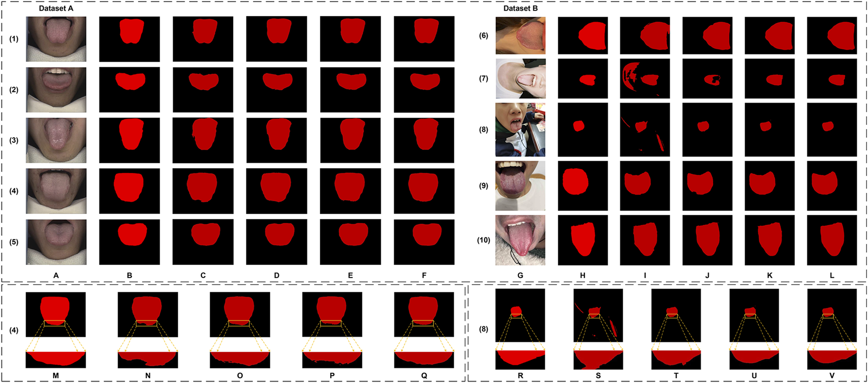 Two datasets labeled A and B compare tongue images with their corresponding red-outlined segmentation masks on black backgrounds. Rows 1 to 5 feature Dataset A, while rows 6 to 10 feature Dataset B. The first column shows the original tongue images, followed by columns of their segmented versions. The bottom section highlights detailed views, focusing on different segmentation aspects for specific images.