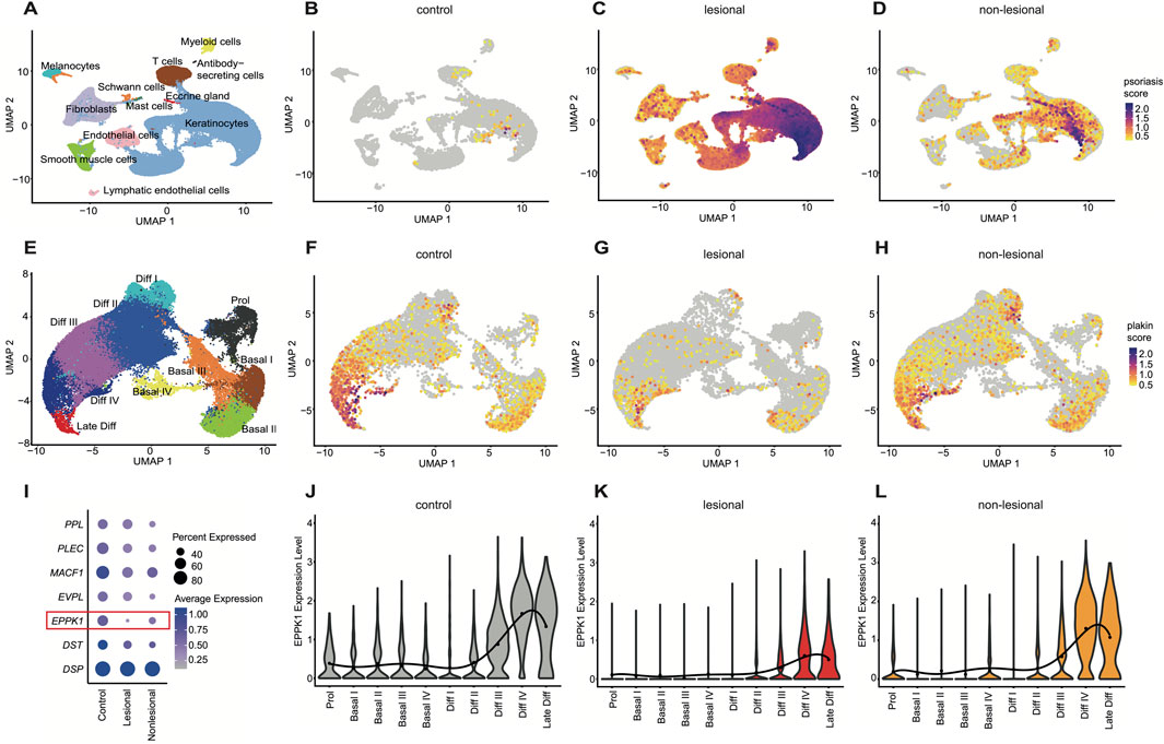 Panel of visualizations showing UMAP plots and expression data. (A) UMAP of various cell types labeled in different colors. (B-D) UMAP plots comparing control, lesional, and non-lesional samples with a color gradient indicating psoriasis score. (E-H) UMAP plots with a color gradient indicating plakin score. (I) Dot plot showing expression levels of different genes across conditions, with EPPK1 highlighted. (J-L) Violin plots showing EPPK1 expression levels across different cell types in control, lesional, and non-lesional samples, with distinct color coding.