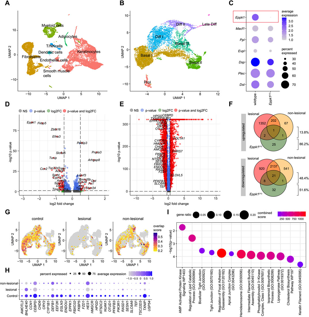A series of scientific visualizations depicting various data analyses. Image A shows a UMAP scatter plot clustering different cell types. Image B presents another UMAP plot with different cell states. Image C is a dot plot showing gene expression levels and percentages. Image D and E are volcano plots illustrating gene expression changes with p-values and log fold changes. Image F contains Venn diagrams comparing differentially expressed genes. Image G includes UMAP plots indicating overlap scores for control, lesional, and non-lesional samples, along with a bubble chart of gene ratios. Image H is a dot plot displaying percent expression and average expression levels across conditions.