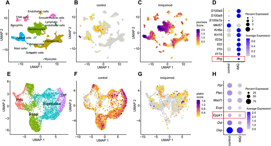 Panel of eight scatter plots and bubble charts analyzing cell types and gene expression related to psoriasis. Panels A, B, C, E, F, and G show UMAP plots of cell distribution under control and imiquimod conditions, with color coding indicating various scores. Panels D and H display bubble charts depicting gene expression levels and percent expressed, with highlighted genes