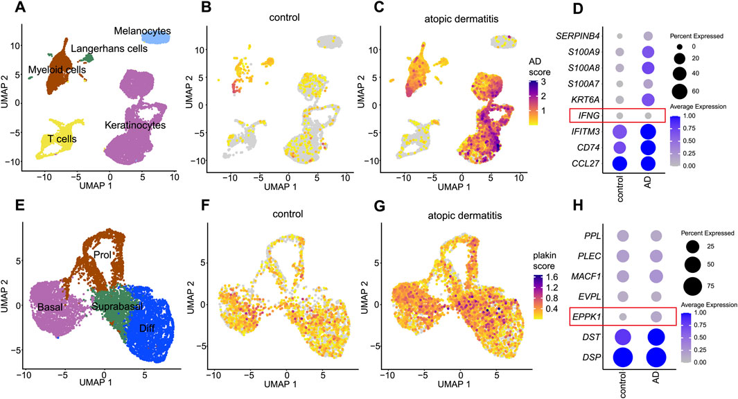 Grouped UMAP plots and bubble plots analyzing immune and keratinocyte subsets in control versus atopic dermatitis. Panels A-C show cell type distributions and UMAP scores. Panels D and H depict expression levels of various genes, with highlighted genes IFNG and EPPK1. Panels E-G illustrate detailed keratinocyte subsets. Color scales indicate expression and score intensities.