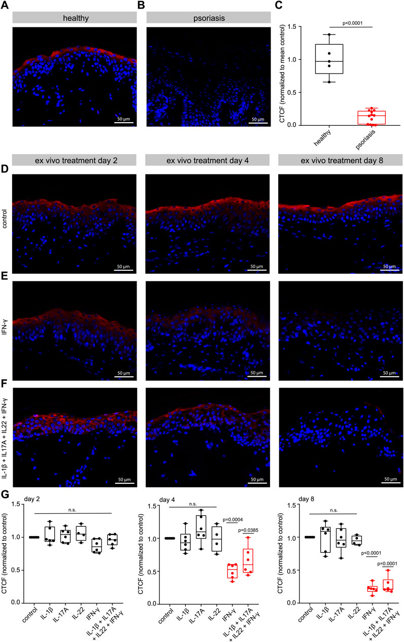 Immunofluorescence images and box plots illustrate CTCF intensity in skin samples. Panels A and B show healthy and psoriatic skin, respectively. Panel C depicts a significant decrease in CTCF in psoriatic samples. Panels D to F detail effects of ex vivo treatments over days two, four, and eight, under different conditions: control, IFN-γ, and IL-17A + IL-22 + IFN-γ. Panel G shows box plots comparing CTCF intensity normalized to control for each condition over time, indicating statistical significance and non-significance with specific combinations and treatments. Scale bar indicates 50 micrometers.