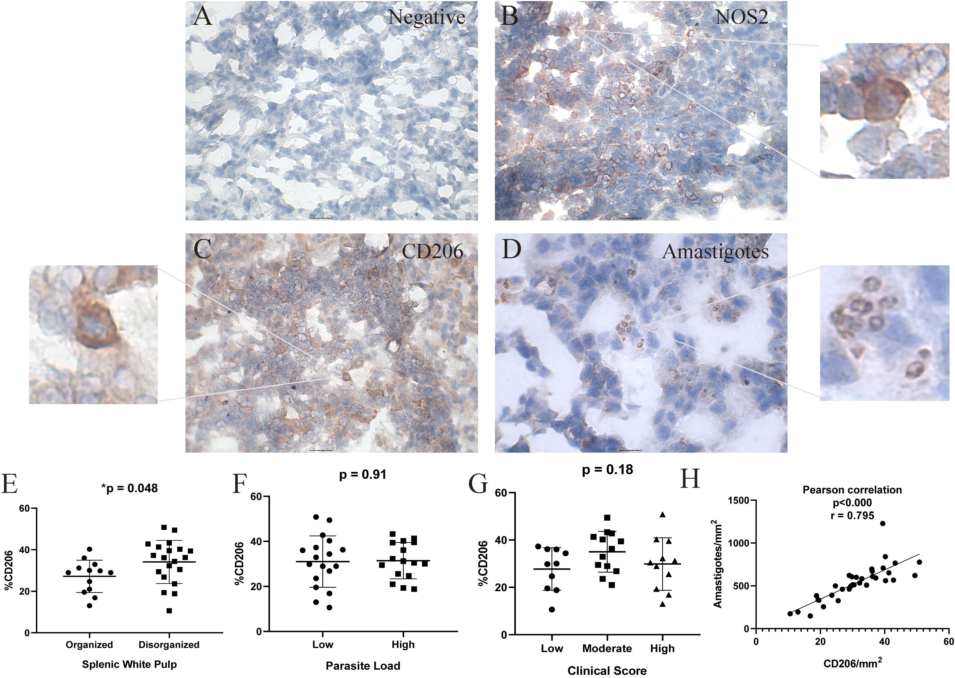 Microscopic images and scatter plots show spleen samples and statistical data. A) Negative control. B) NOS2 expression. C) CD206 expression. D) Presence of amastigotes. E) Scatter plot of CD206 in organized versus disorganized splenic white pulp. F) CD206 percentage comparing low and high parasite loads. G) CD206 percentage across clinical scores. H) Correlation between CD206/mm² and amastigotes density, showing a Pearson correlation of 0.795.