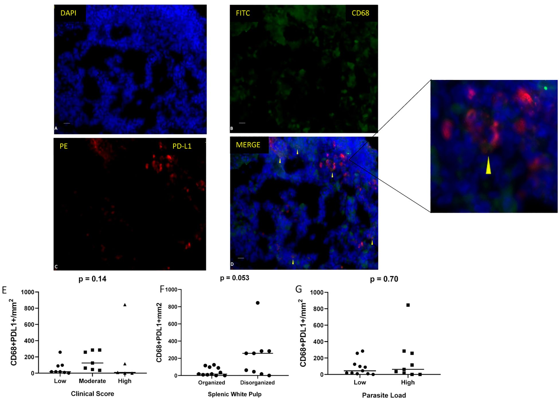 Fluorescence microscopy images labeled A-D and corresponding graphs E-G. Image A shows DAPI staining in blue. Image B shows FITC-labeled CD68 in green. Image C shows PE-labeled PD-L1 in red. Image D is a merged image showing co-localization indicated by yellow arrows, with a zoomed-in section. Graphs E-G display scatter plots of CD68+PD-L1+ cells per mm² across different clinical scores, splenic white pulp organization, and parasite load, showing variability among the scores and conditions.