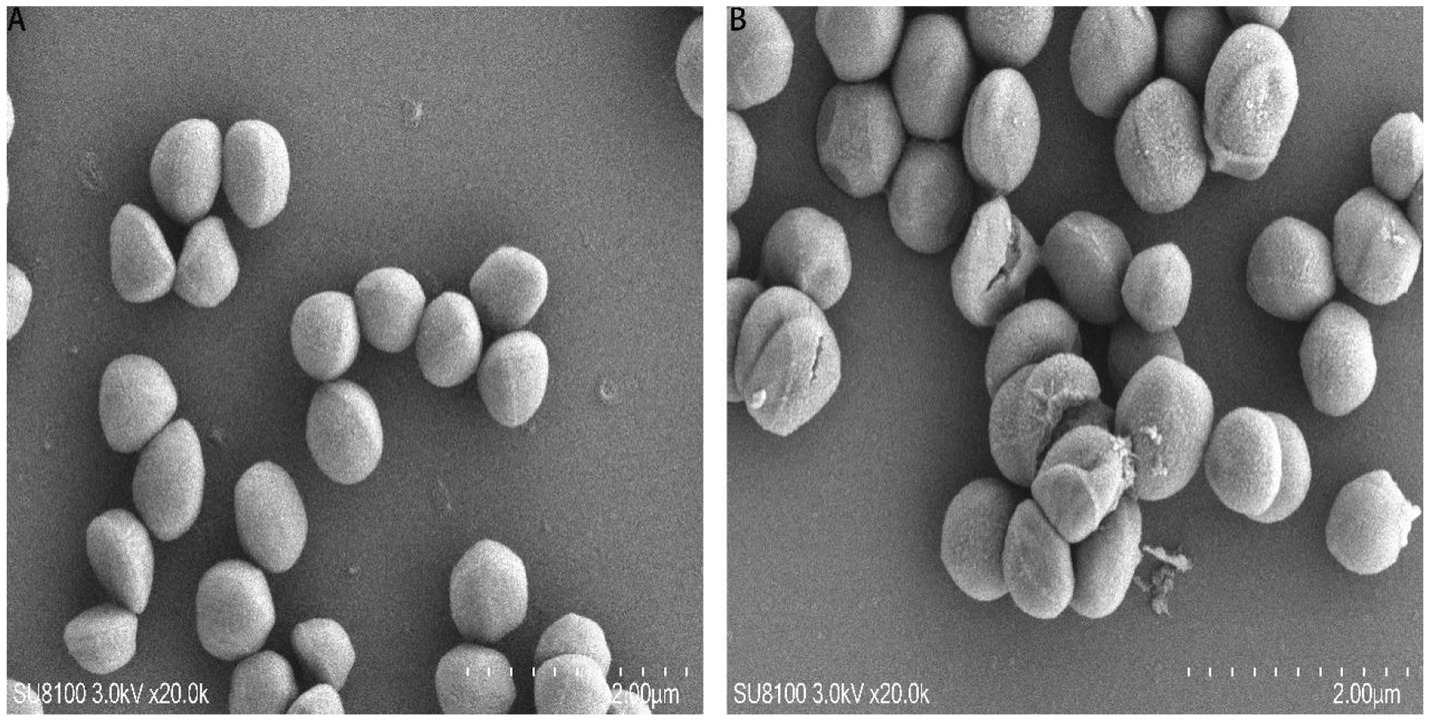 Electron microscope images showing two panels labeled A and B. Panel A displays several spherical particles, smooth and isolated. Panel B shows similar spherical particles, some with irregular surfaces and clumping together. Both images are magnified at 20,000 times, with a scale indicating two micrometers.