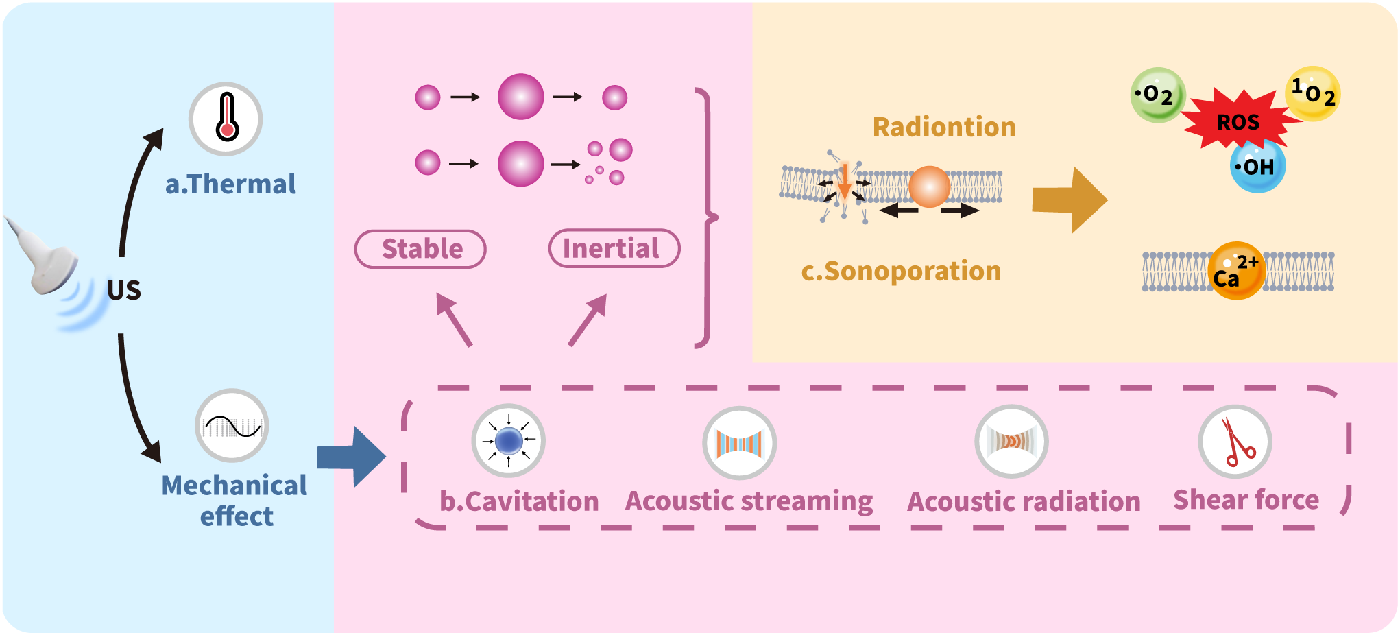 Diagram illustrating the effects of ultrasound (US) on biological systems. The left section shows thermal and mechanical effects from US. Cavitation is highlighted, with stable and inertial processes. The right section illustrates sonoporation leading to radiotion reactions, generating reactive oxygen species (ROS) and calcium ion exchange.