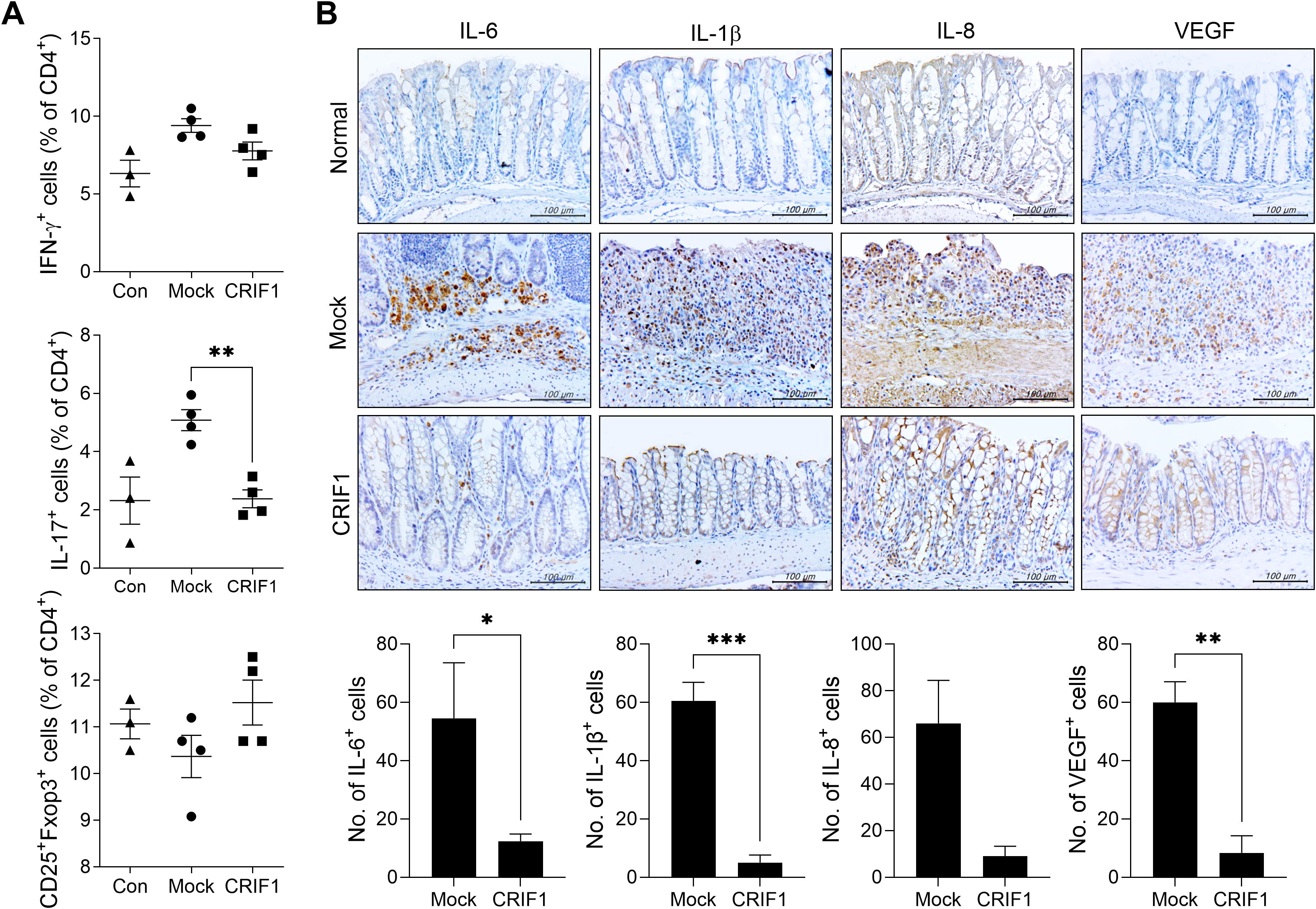 Panel A shows three scatter plots comparing percentages of IFN-γ+, IL-17+, and CD25+Foxp3+ cells among CD4+ cells across three conditions: Con, Mock, and CRIF1. A significant decrease in IL-17+ cells is marked between the Mock and CRIF1 groups. Panel B contains five columns of immunohistochemistry images for IL-6, IL-1β, IL-8, and VEGF, with rows indicating Normal, Mock, and CRIF1 conditions. CRIF1 shows reduced staining compared to Mock. Bar graphs below show significant decreases in the number of IL-6+, IL-1β+, and VEGF+ cells in CRIF1 compared to Mock, denoted by asterisks.