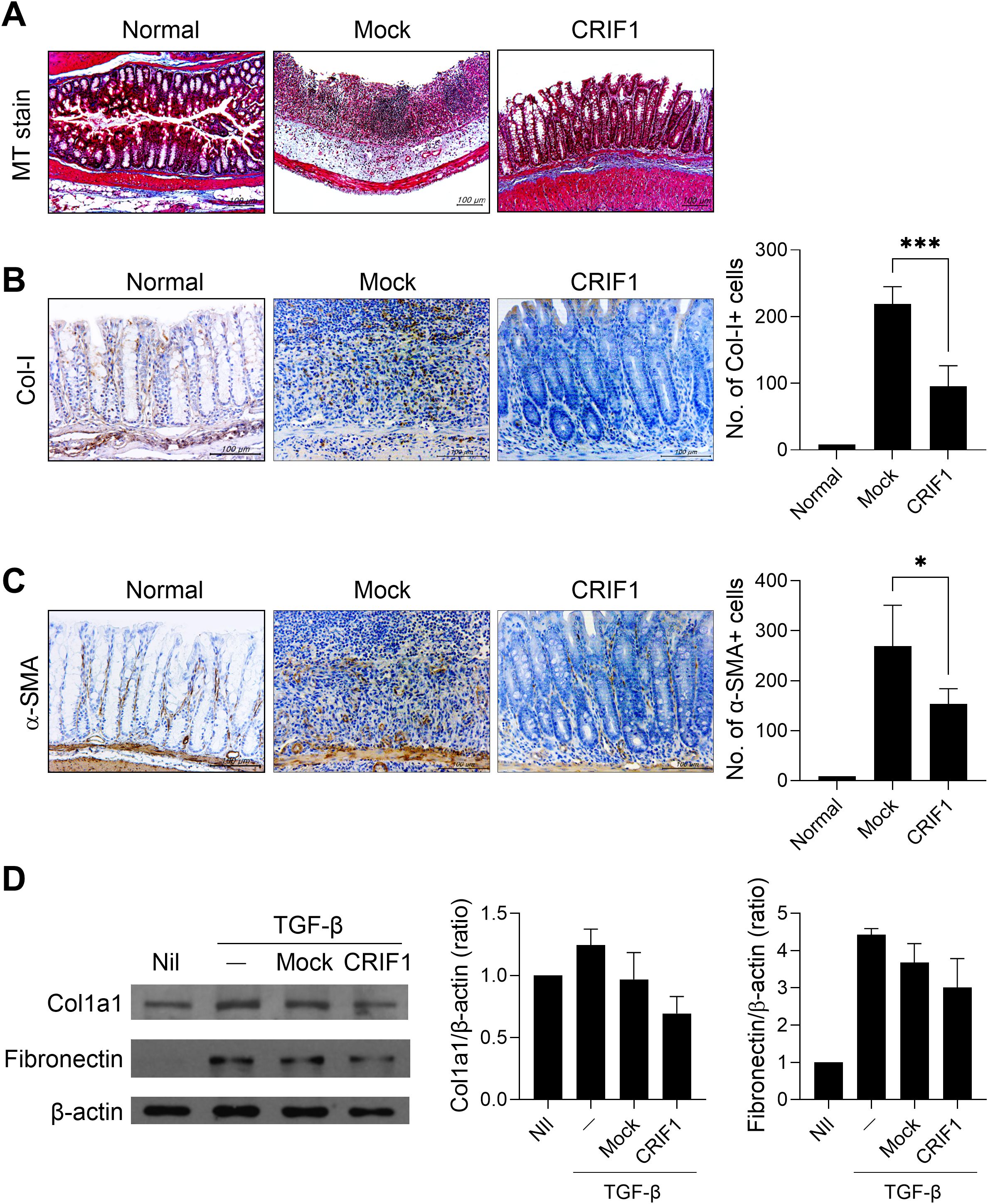 Panel A displays MT stain images of tissue sections labeled as Normal, Mock, and CRIF1, showing structural differences. Panel B features Col-I stain images with a bar graph indicating increased Col-I+ cells in CRIF1 compared to Normal and Mock. Panel C presents α-SMA stain images with a graph showing a rise in α-SMA+ cells in CRIF1. Panel D contains Western blot images for Col1a1, Fibronectin, and β-actin under different conditions, along with graphs illustrating Col1a1/β-actin and Fibronectin/β-actin ratios.