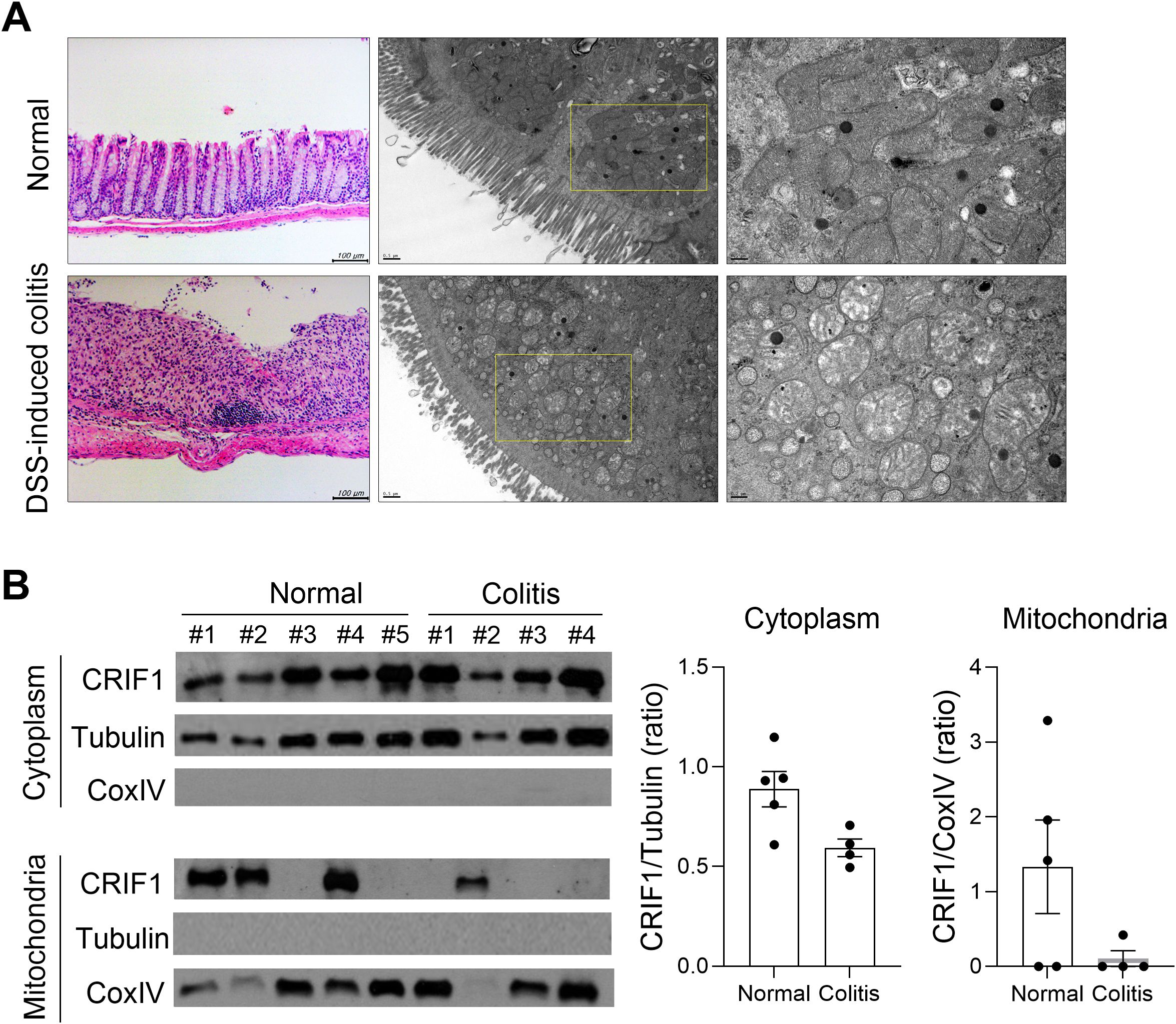 Panel A shows microscopic images comparing normal and DSS-induced colitis colon tissues, with histology and ultrastructure views. Normal tissue shows intact structure, while colitis tissue shows inflammation. Panel B depicts Western blot results for CRIF1, Tubulin, and CoxIV in cytoplasm and mitochondria from normal and colitis samples, with bar graphs illustrating CRIF1 ratio differences between conditions.